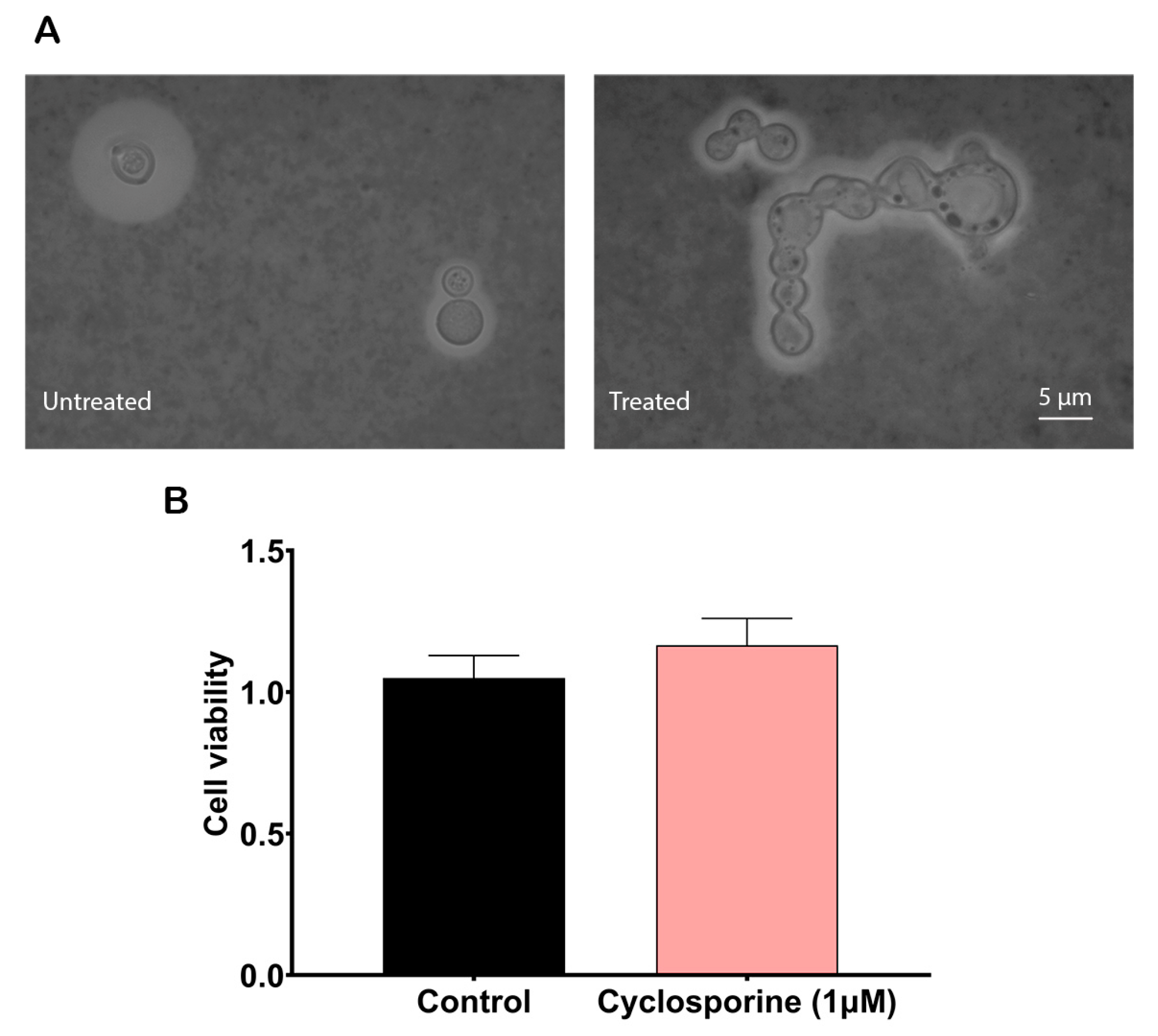 JoF | Free Full-Text | Cyclosporine Affects the Main Virulence Factors of  Cryptococcus neoformans In Vitro