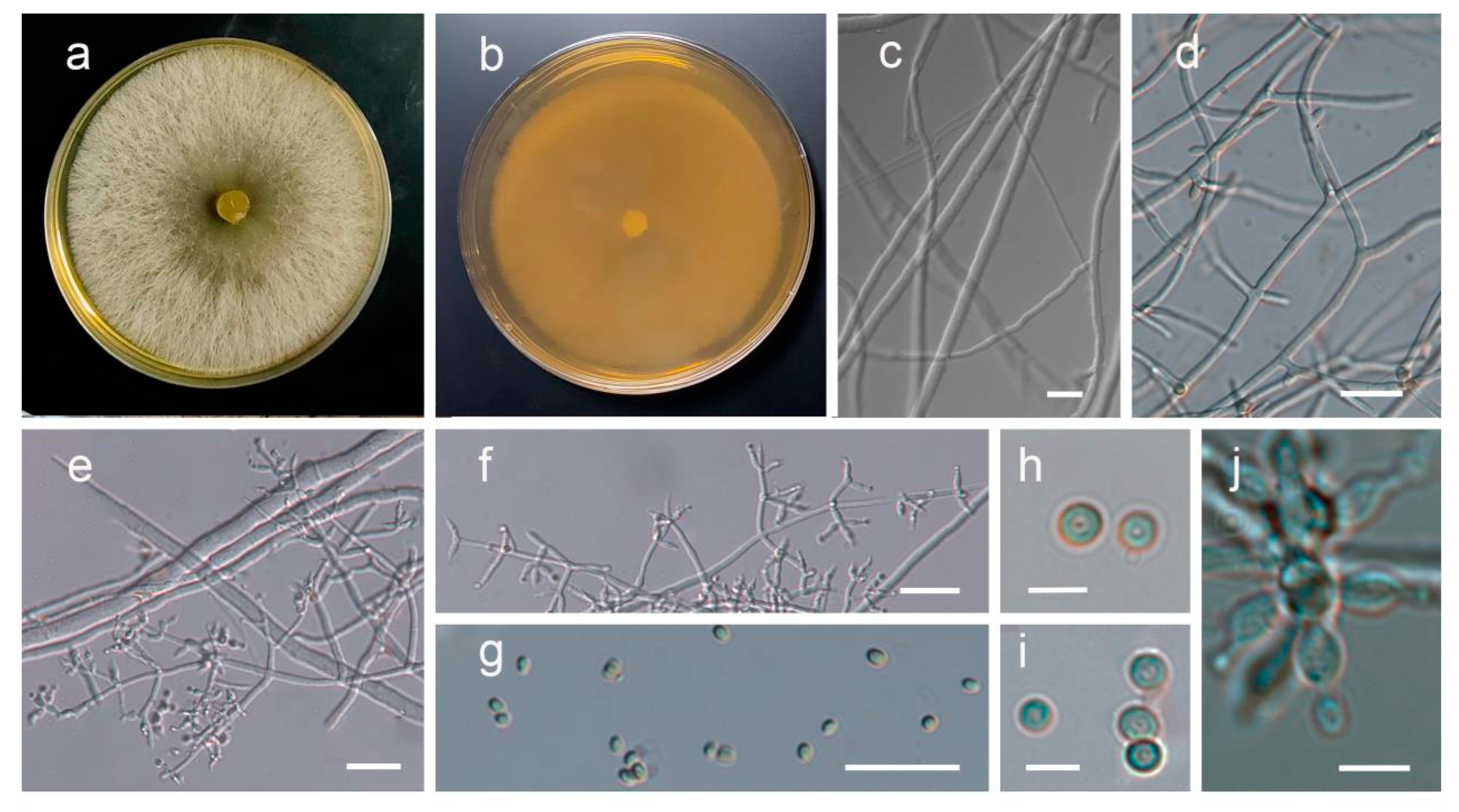 Jof 09 00525 g004 Jof 09 00525 g004