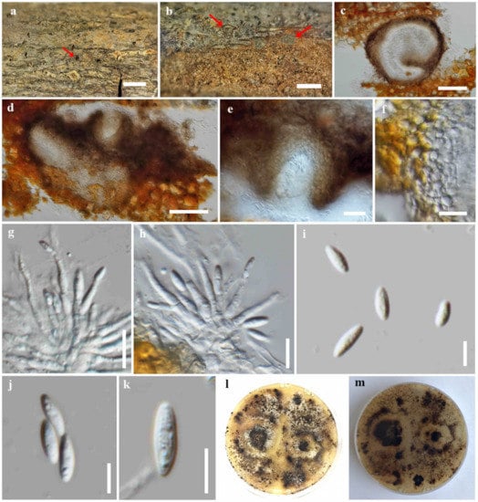 JoF | Free Full-Text | Integrative Taxonomy of Novel Diaporthe Species ...