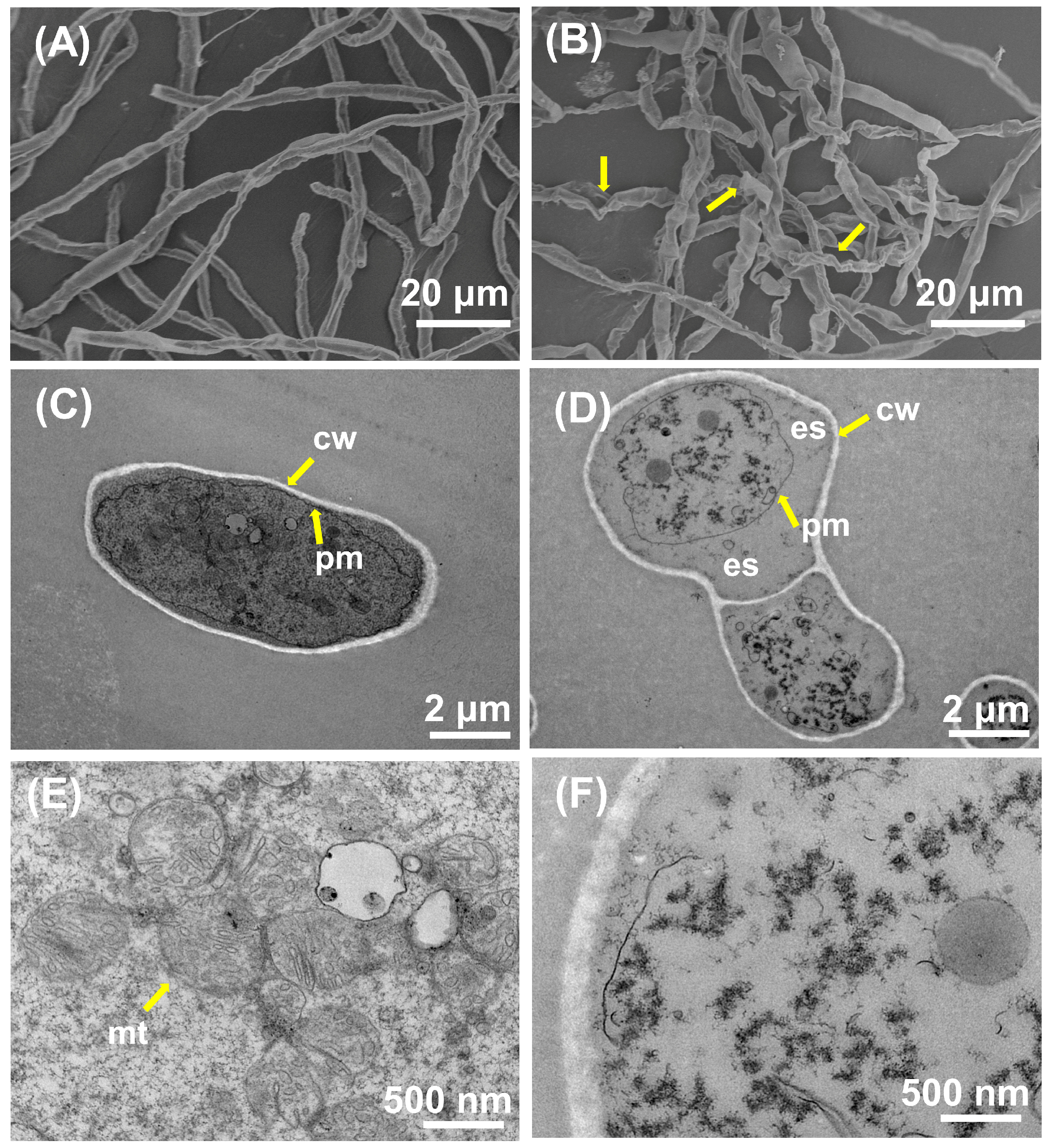 JoF | Free Full-Text | Exploring Mechanisms of Antifungal 