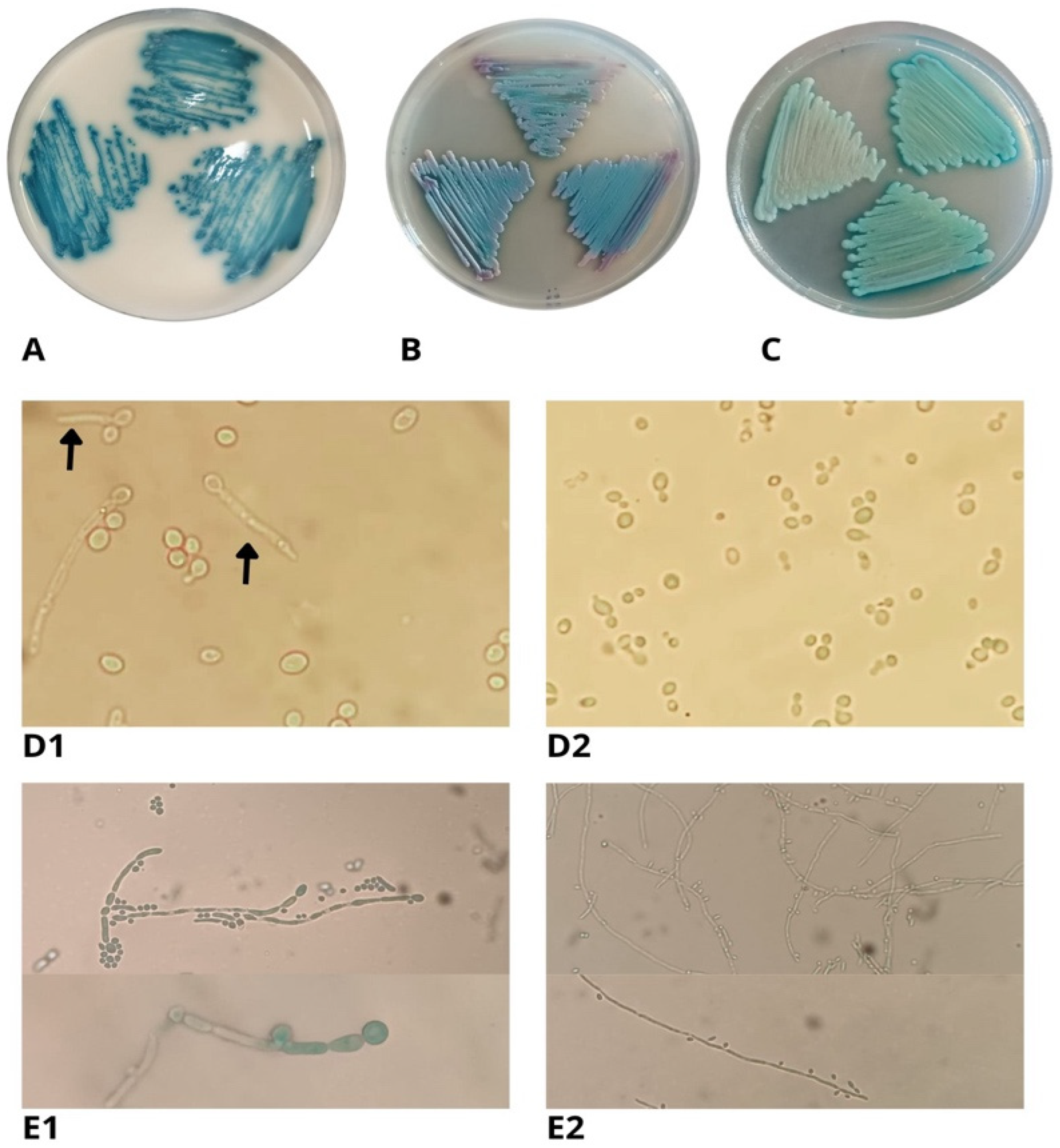 JoF | Free Full-Text | First Report of the Emerging Pathogen