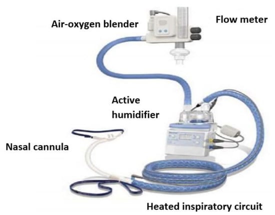 JoR | Free Full-Text | The Effect of High Flow Nasal Cannula Therapy in  Exercised-Induced Asthma of Children