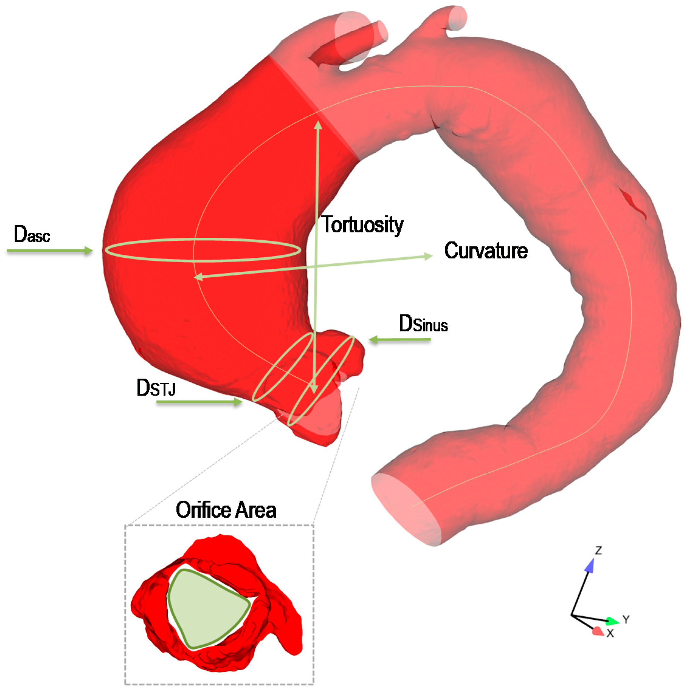 normal size of ascending aorta