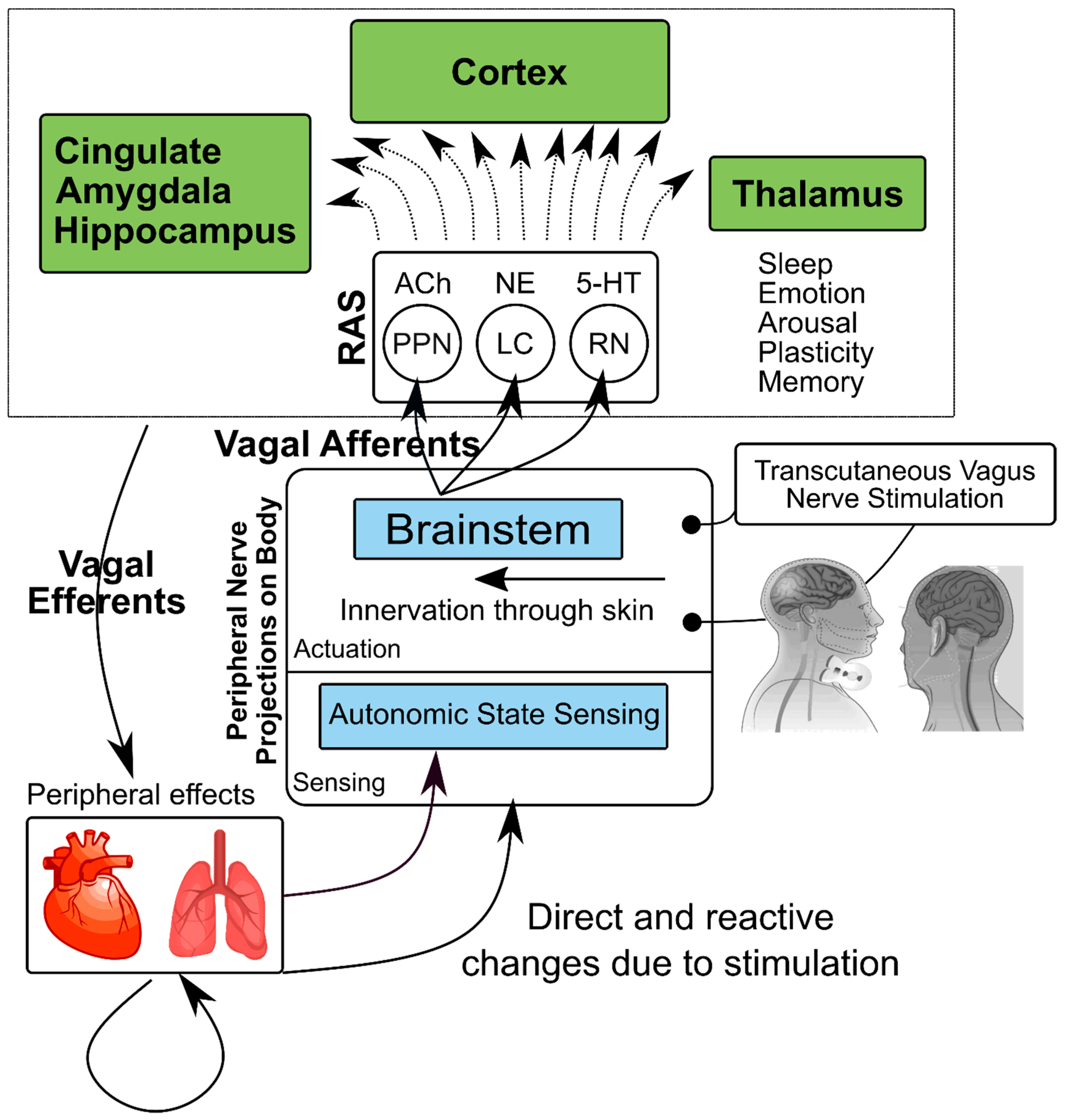 Vagal Nerve Stimulation for Depression and Anxiety