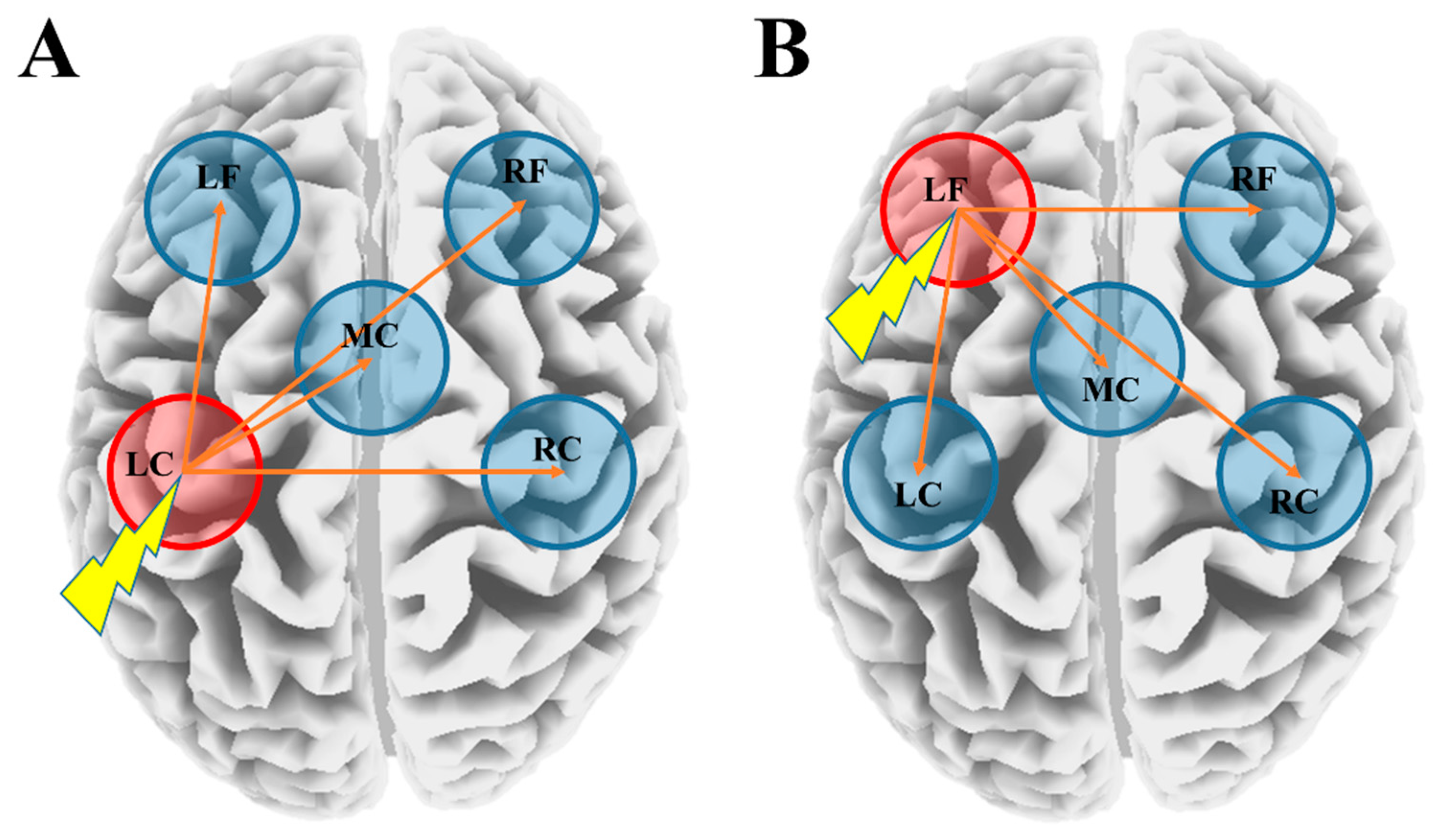 JPM | Free Full-Text | Single-Pulse Transcranial Magnetic  Stimulation-Evoked Potential Amplitudes and Latencies in the Motor and  Dorsolateral Prefrontal Cortex among Young, Older Healthy Participants, and  Schizophrenia Patients