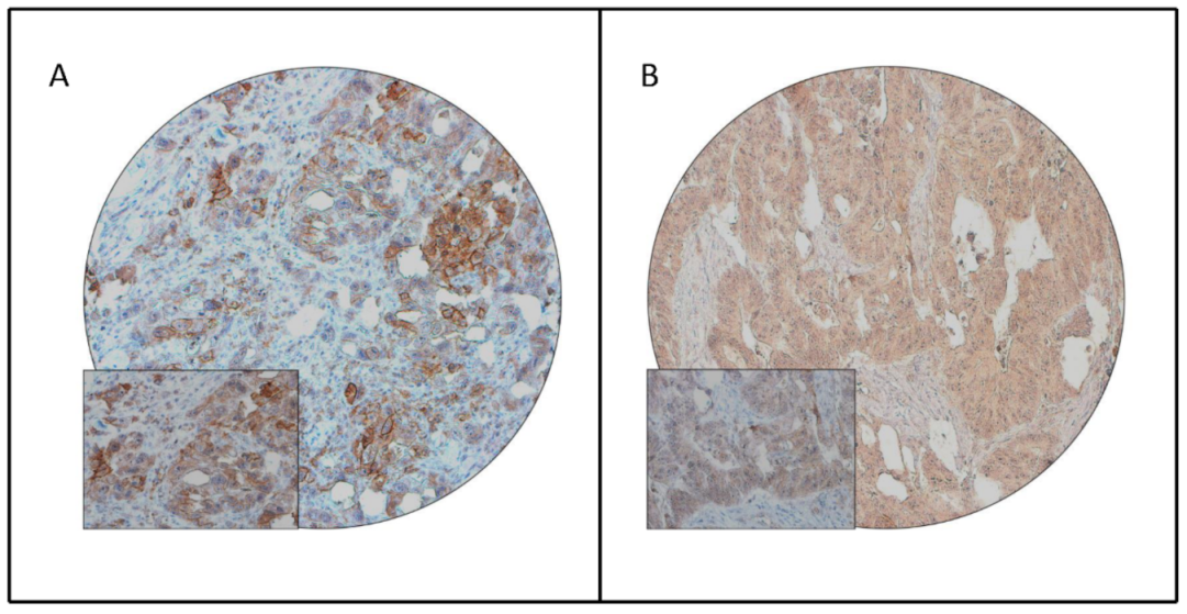 Jpm 11 00073 g001 Jpm 11 00073 g001