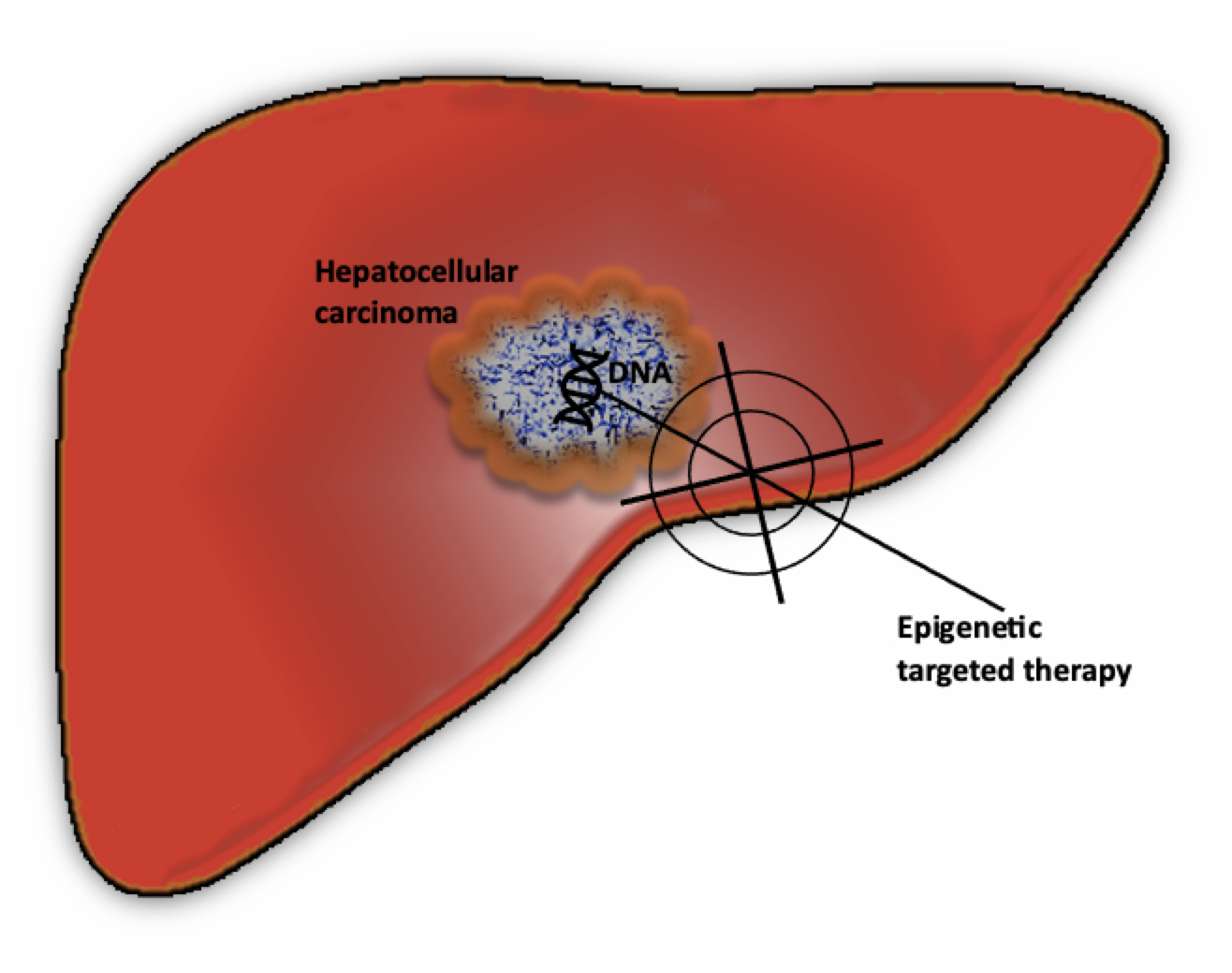 Jpm Free Full Text Histone Deacetylase Inhibitors In The Treatment Of Hepatocellular Carcinoma Current Evidence And Future Opportunities Html