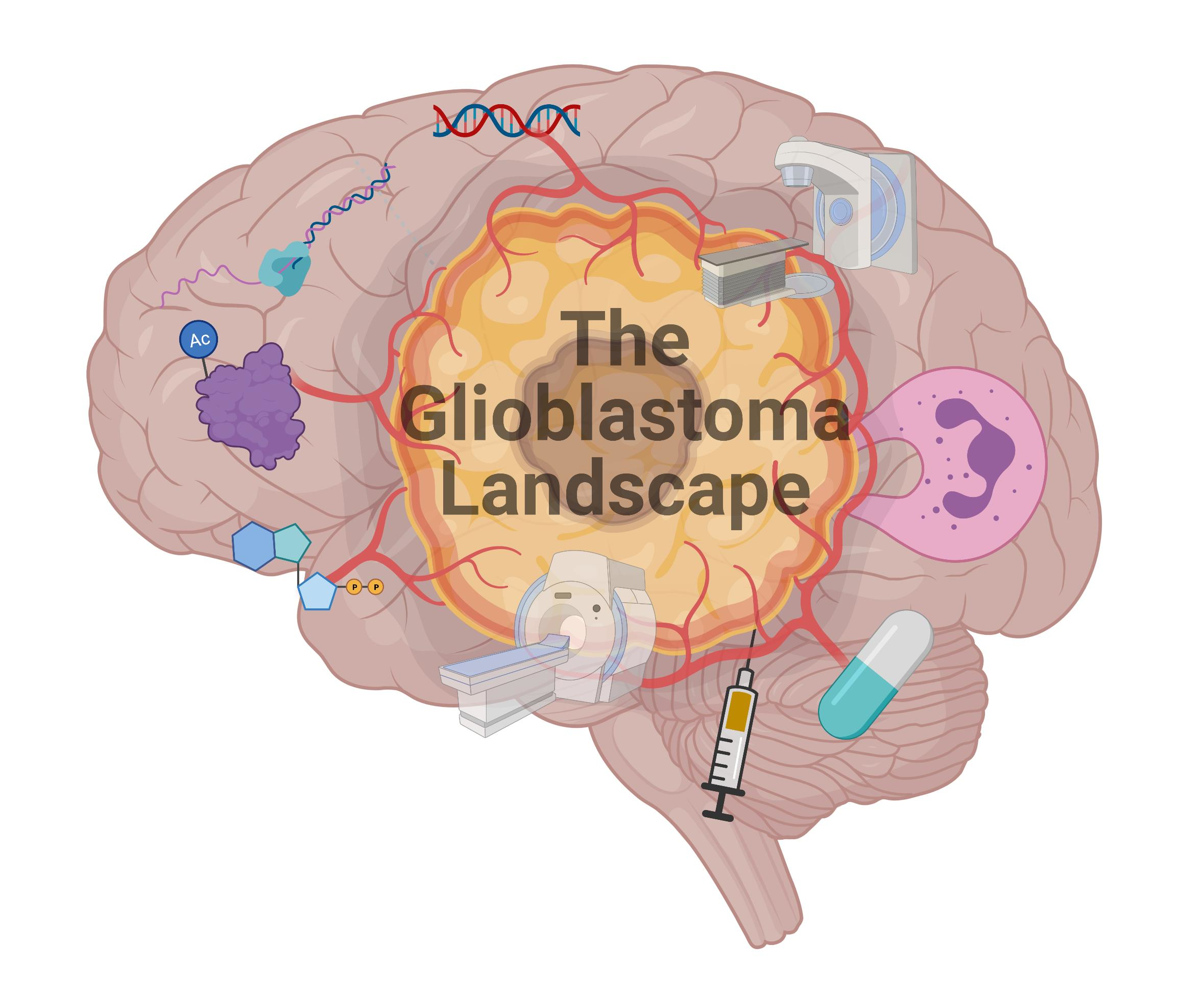 JPM Free FullText Diagnosis and Management of Glioblastoma A