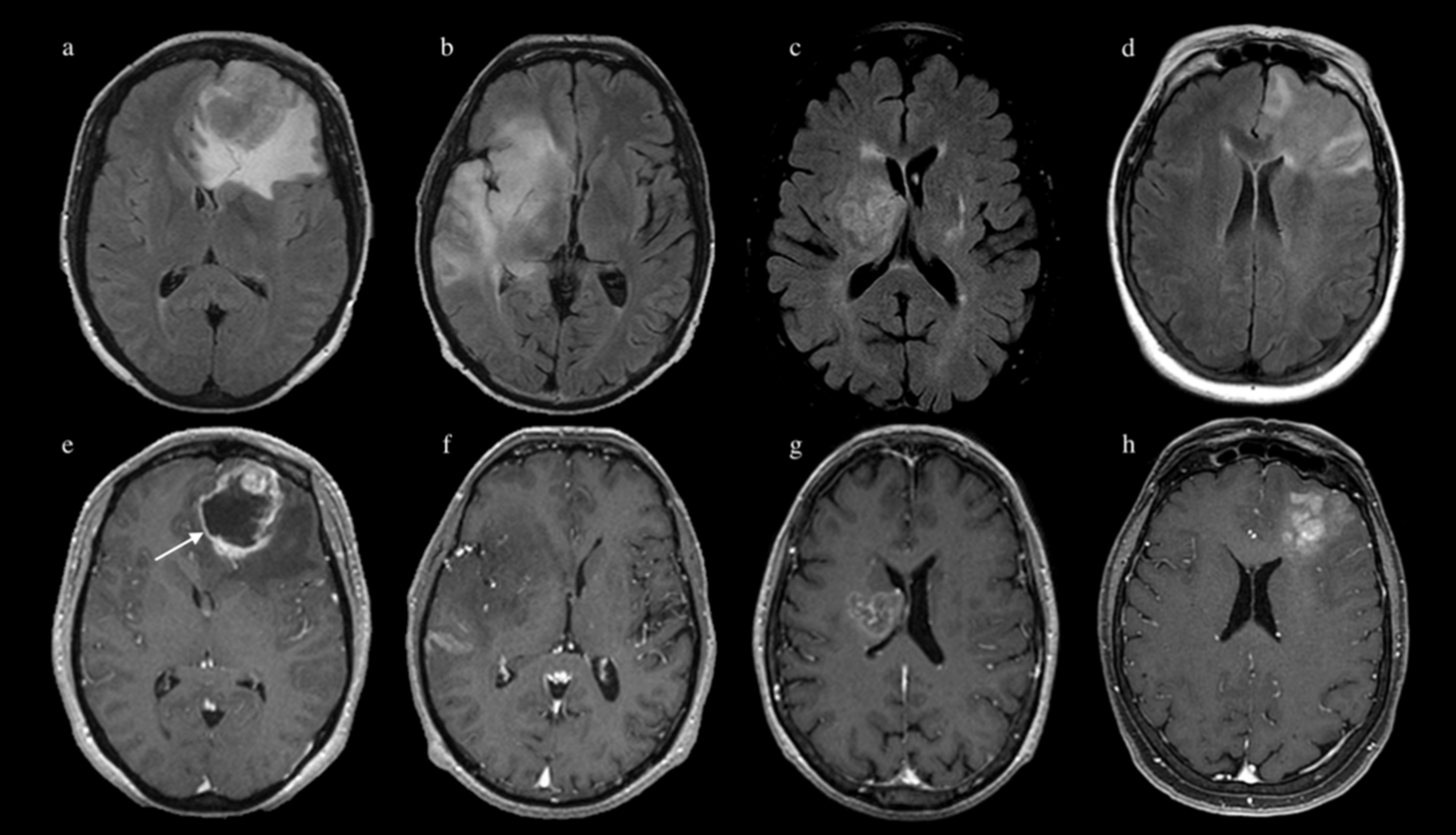 Jpm 11 00290 g001 Jpm 11 00290 g001