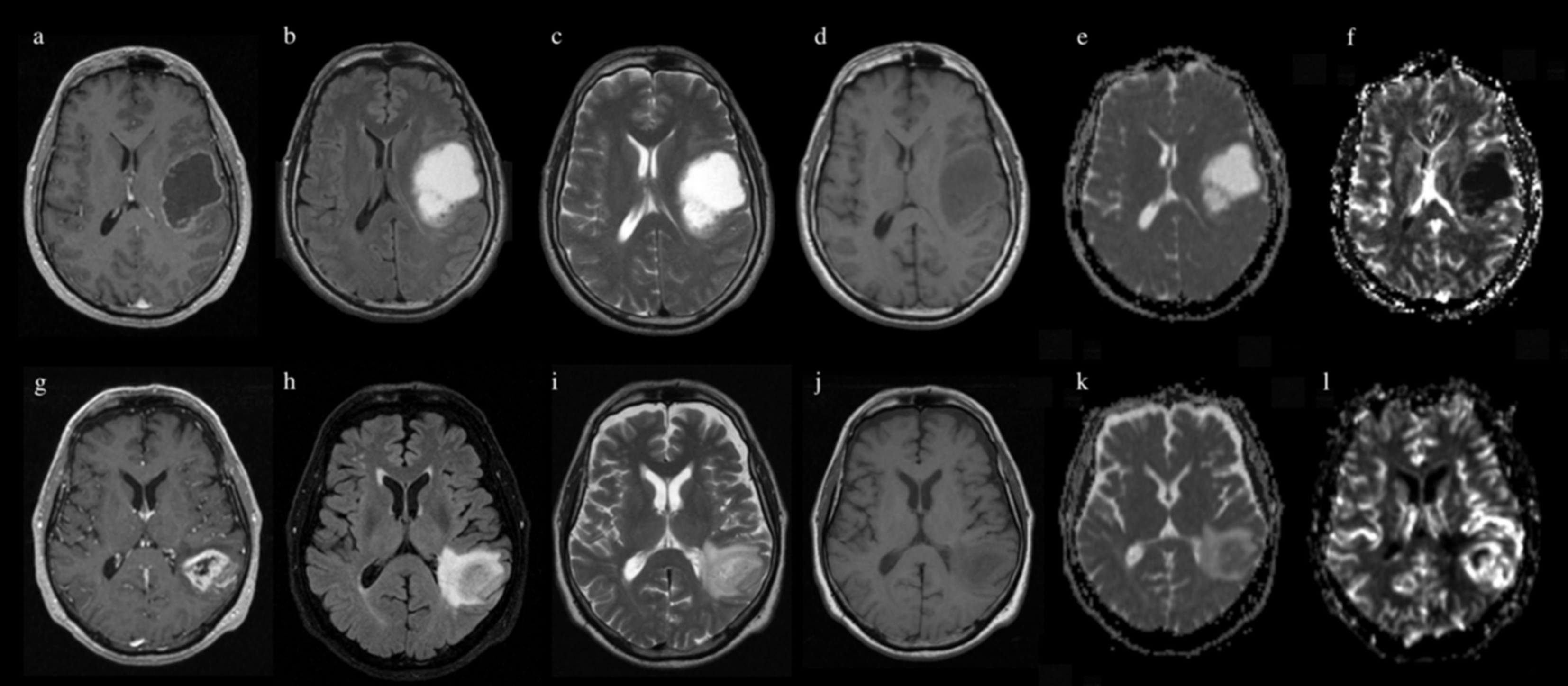 Jpm 11 00290 g005 Jpm 11 00290 g005