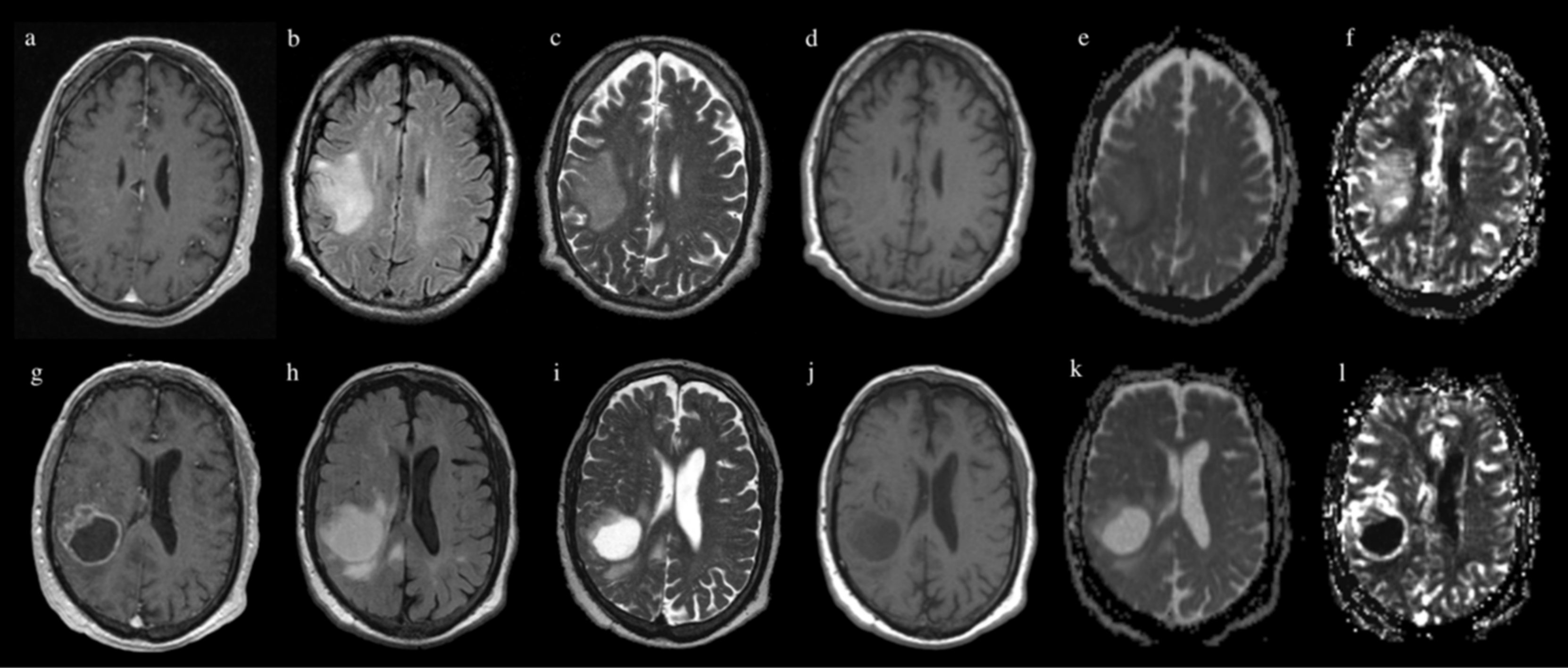 Jpm 11 00290 g006 Jpm 11 00290 g006