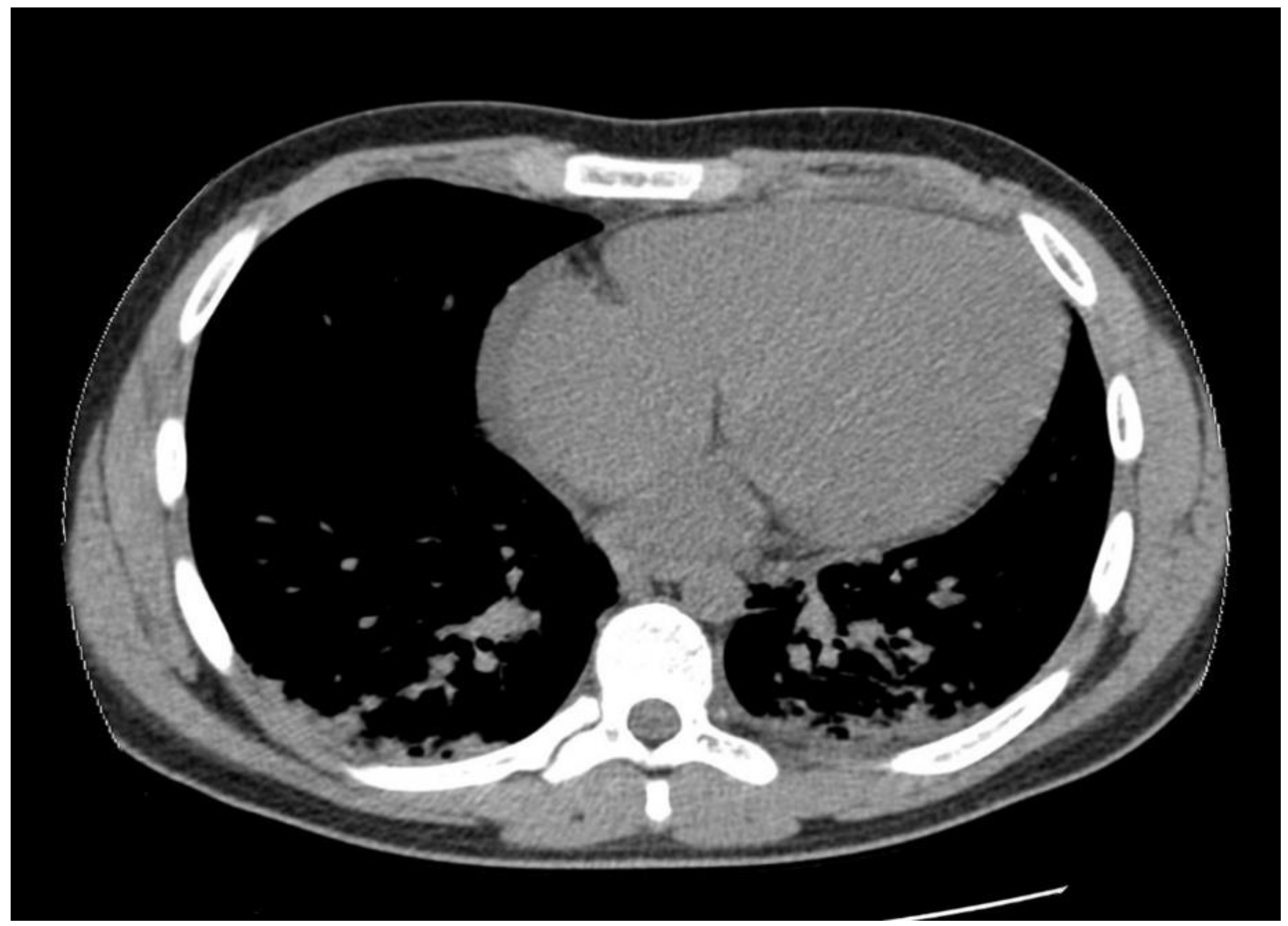 Jpm 11 00318 g005 Jpm 11 00318 g005