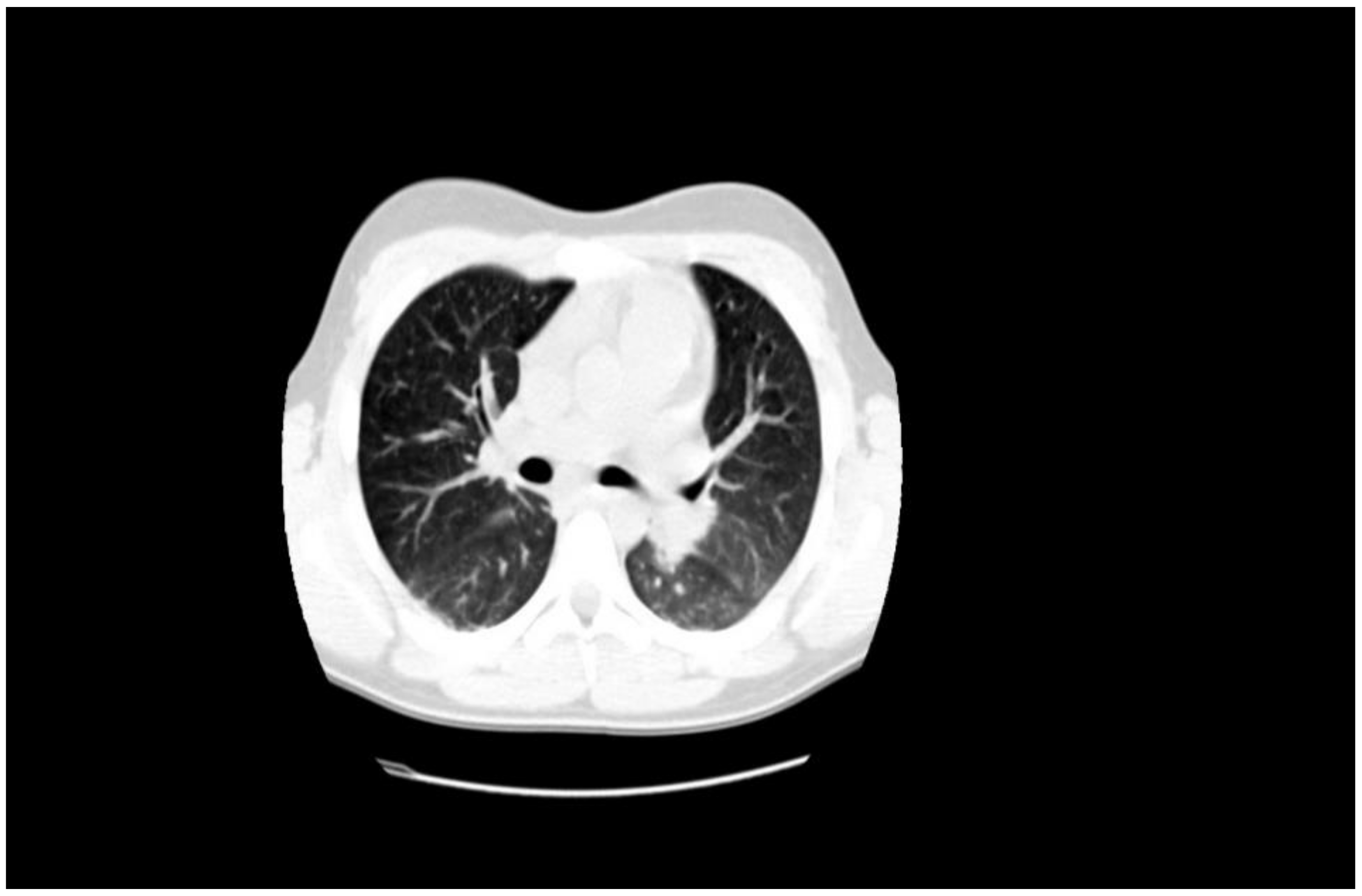 Jpm 11 00318 g006 Jpm 11 00318 g006