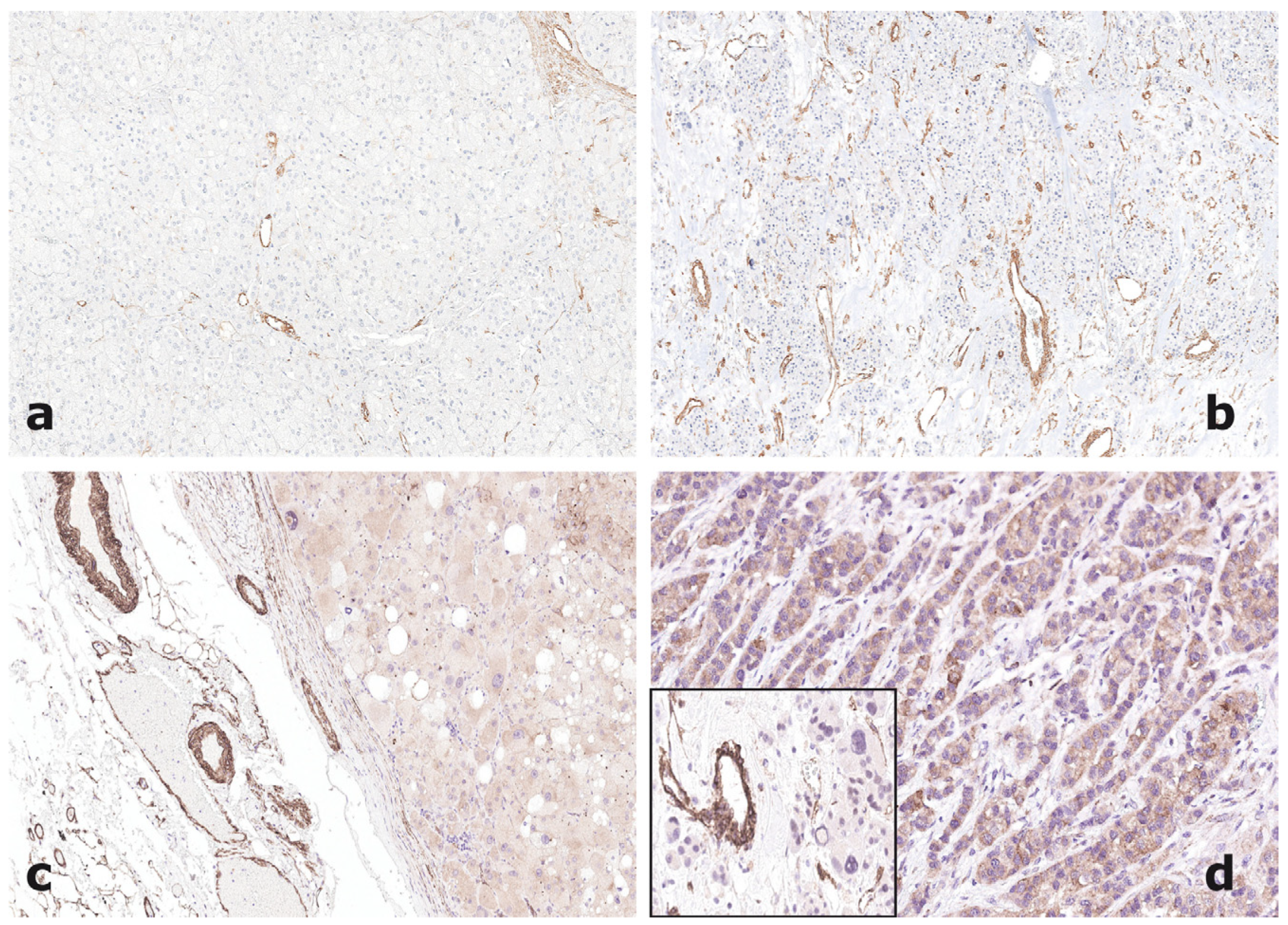 Jpm 11 00378 g002 Jpm 11 00378 g002