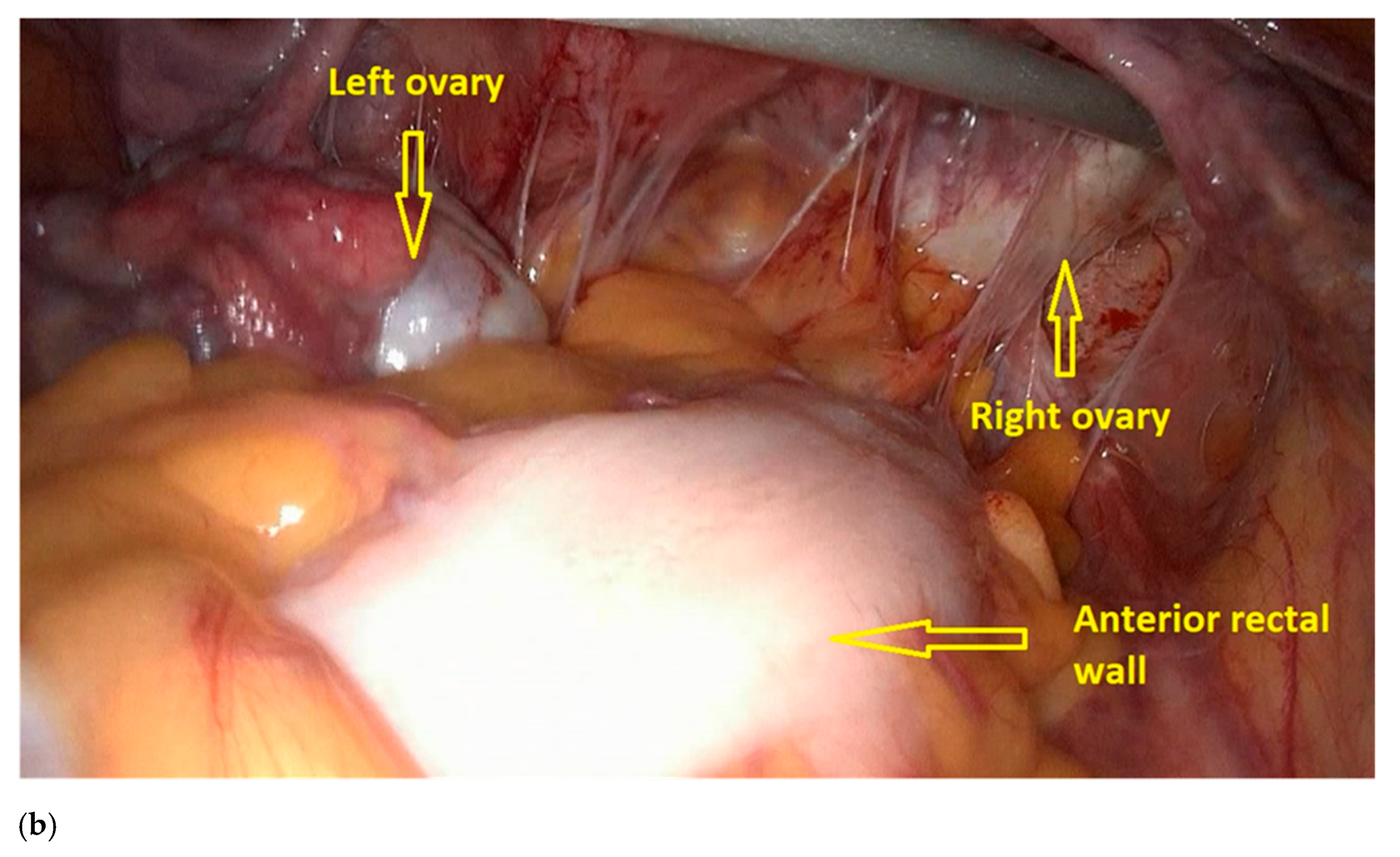 Jpm 11 00408 g002b Jpm 11 00408 g002b