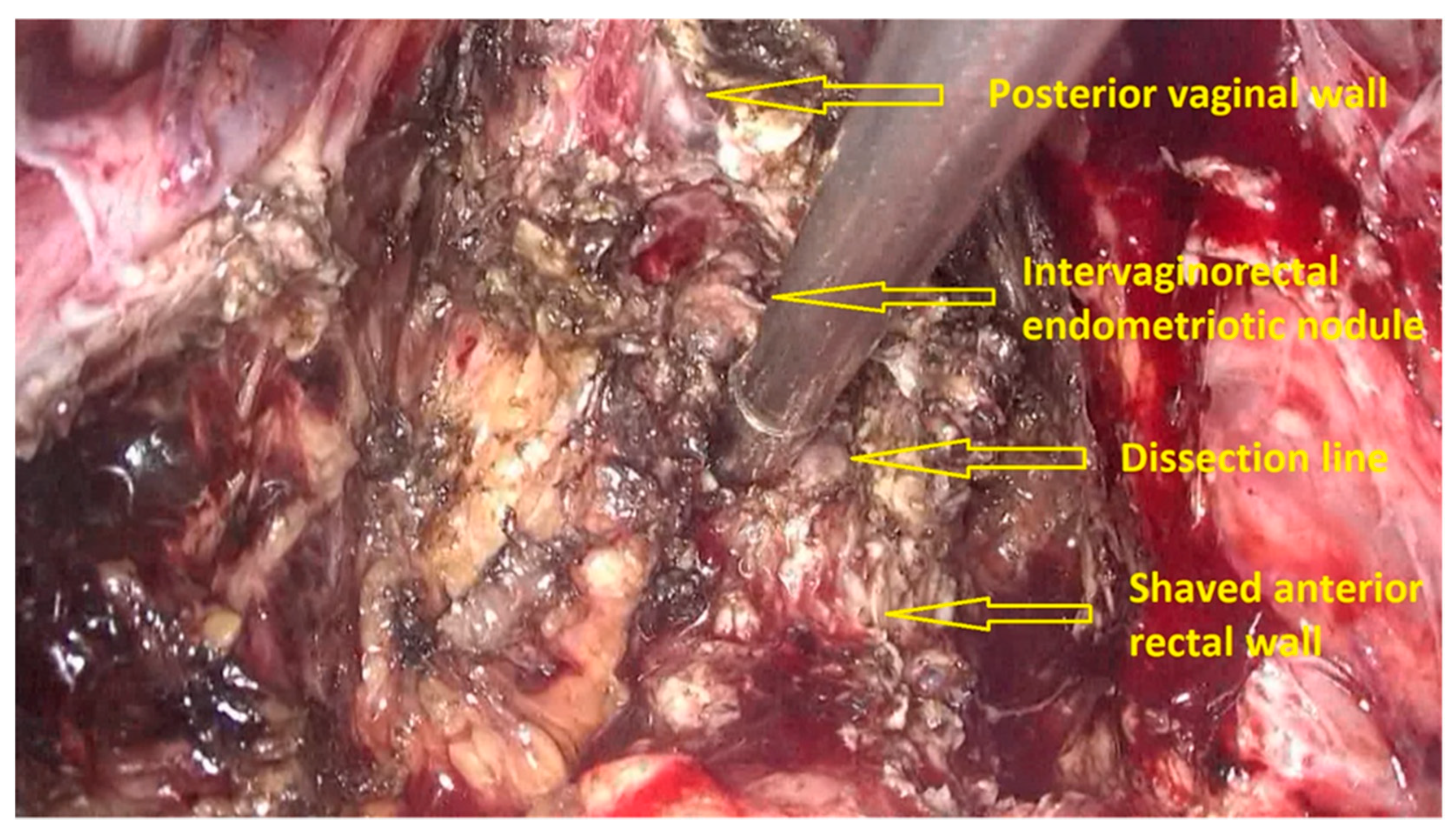 Jpm 11 00408 g003 Jpm 11 00408 g003