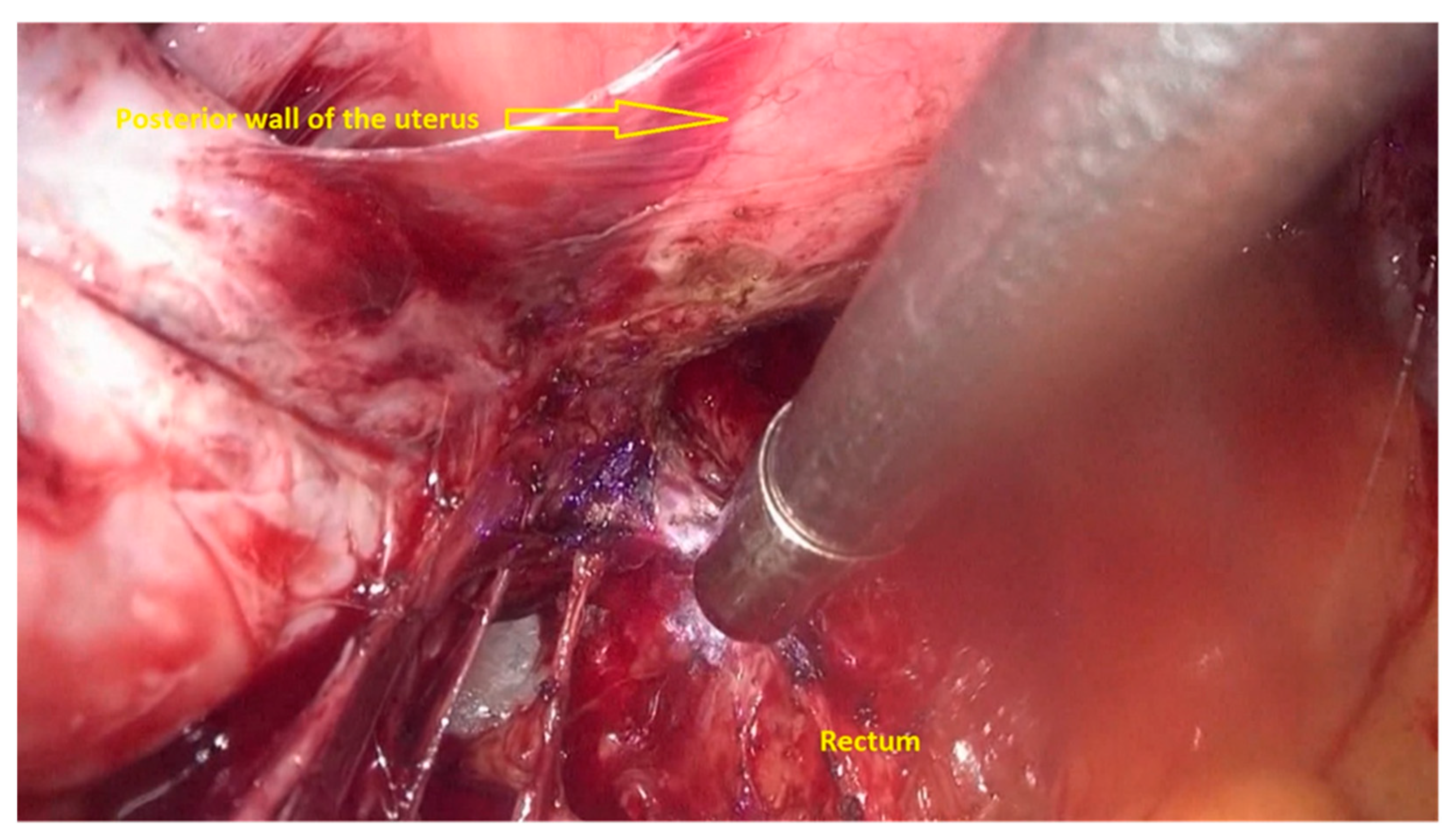 Jpm 11 00408 g004 Jpm 11 00408 g004