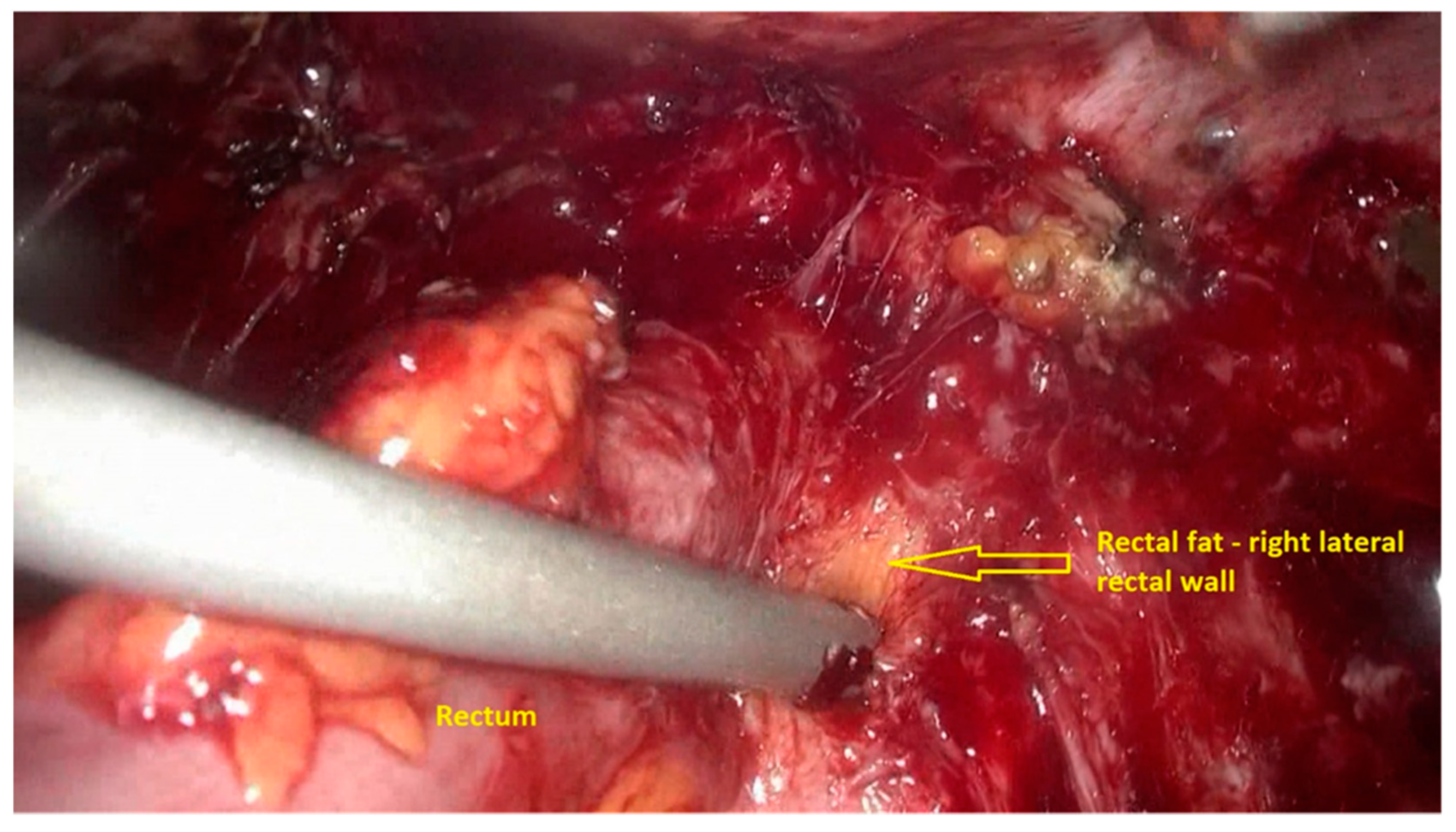 Jpm 11 00408 g005 Jpm 11 00408 g005