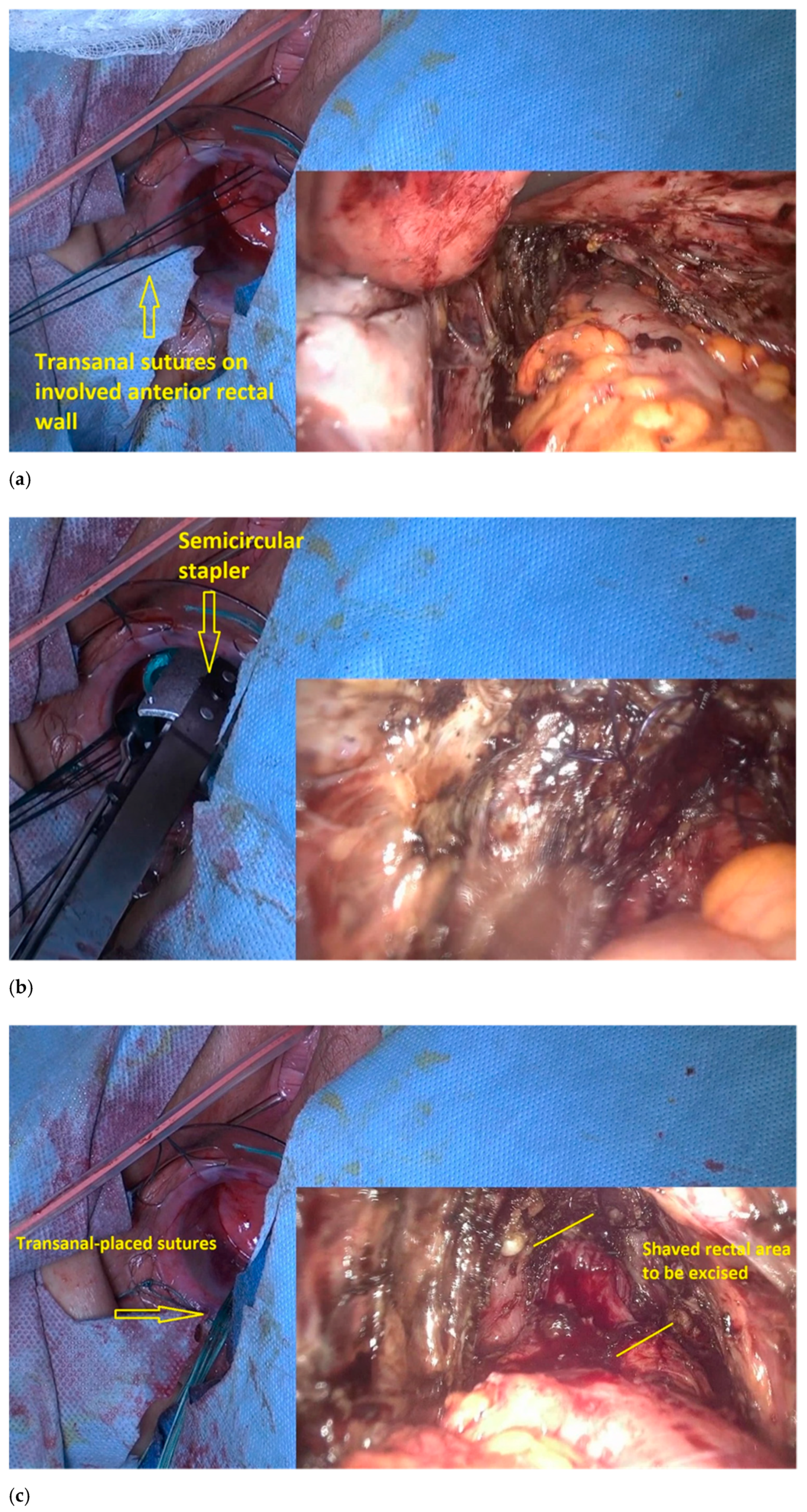 Jpm 11 00408 g007a Jpm 11 00408 g007a