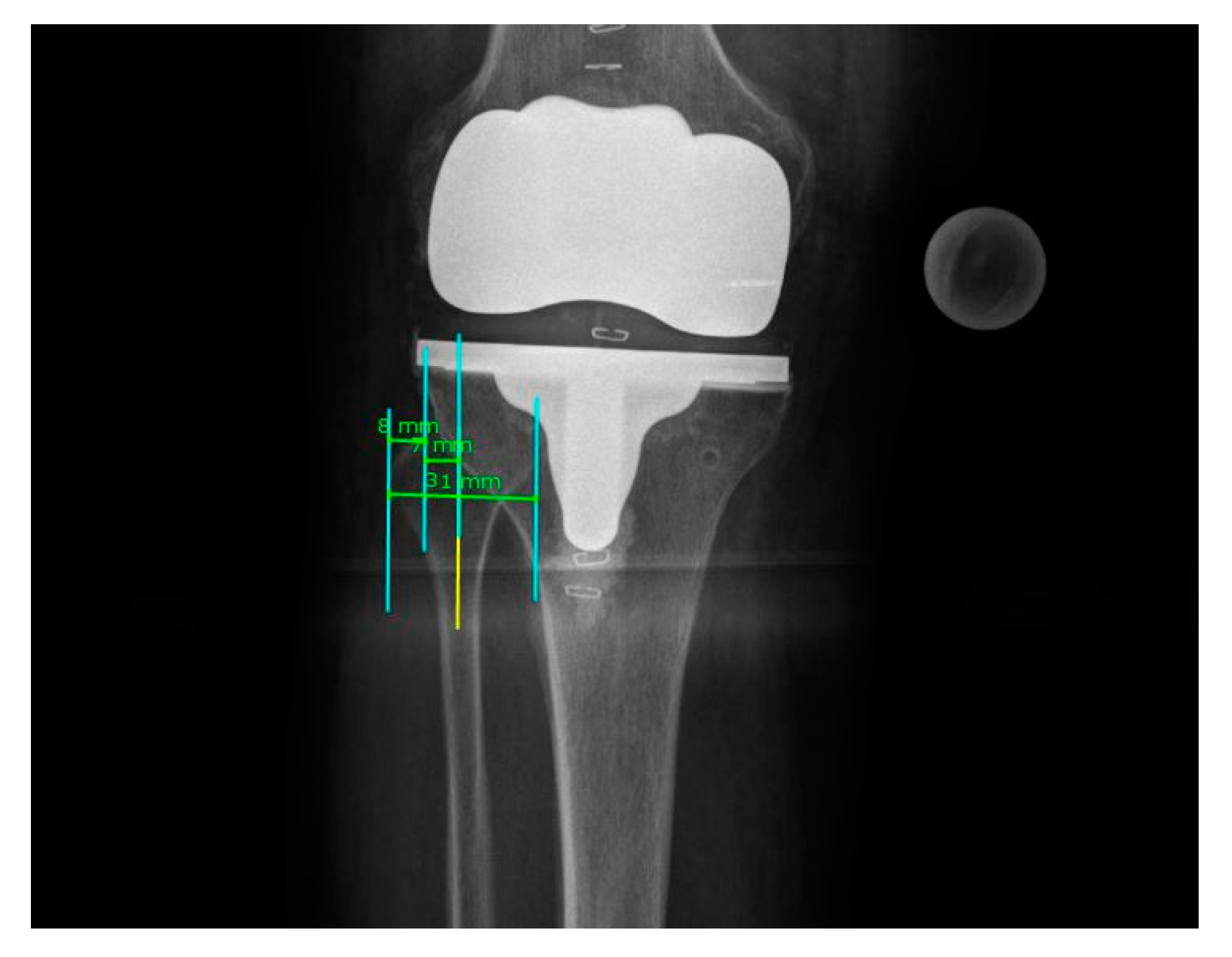 Jpm 11 00549 g002 Jpm 11 00549 g002