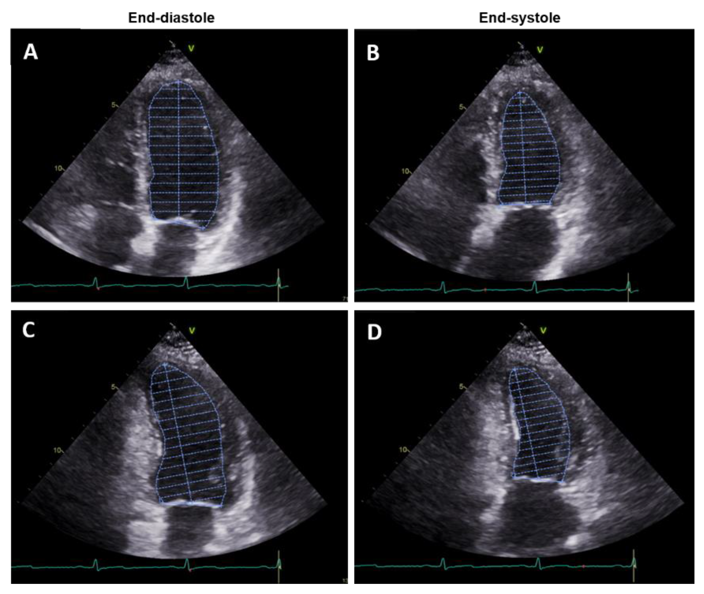 JPM | Free Full-Text | Non-Invasive Assessment of Left Ventricle Ejection  Fraction: Where Do We Stand?