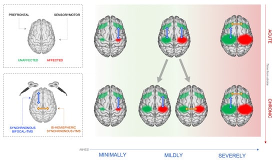 Interhemispheric competition during sleep