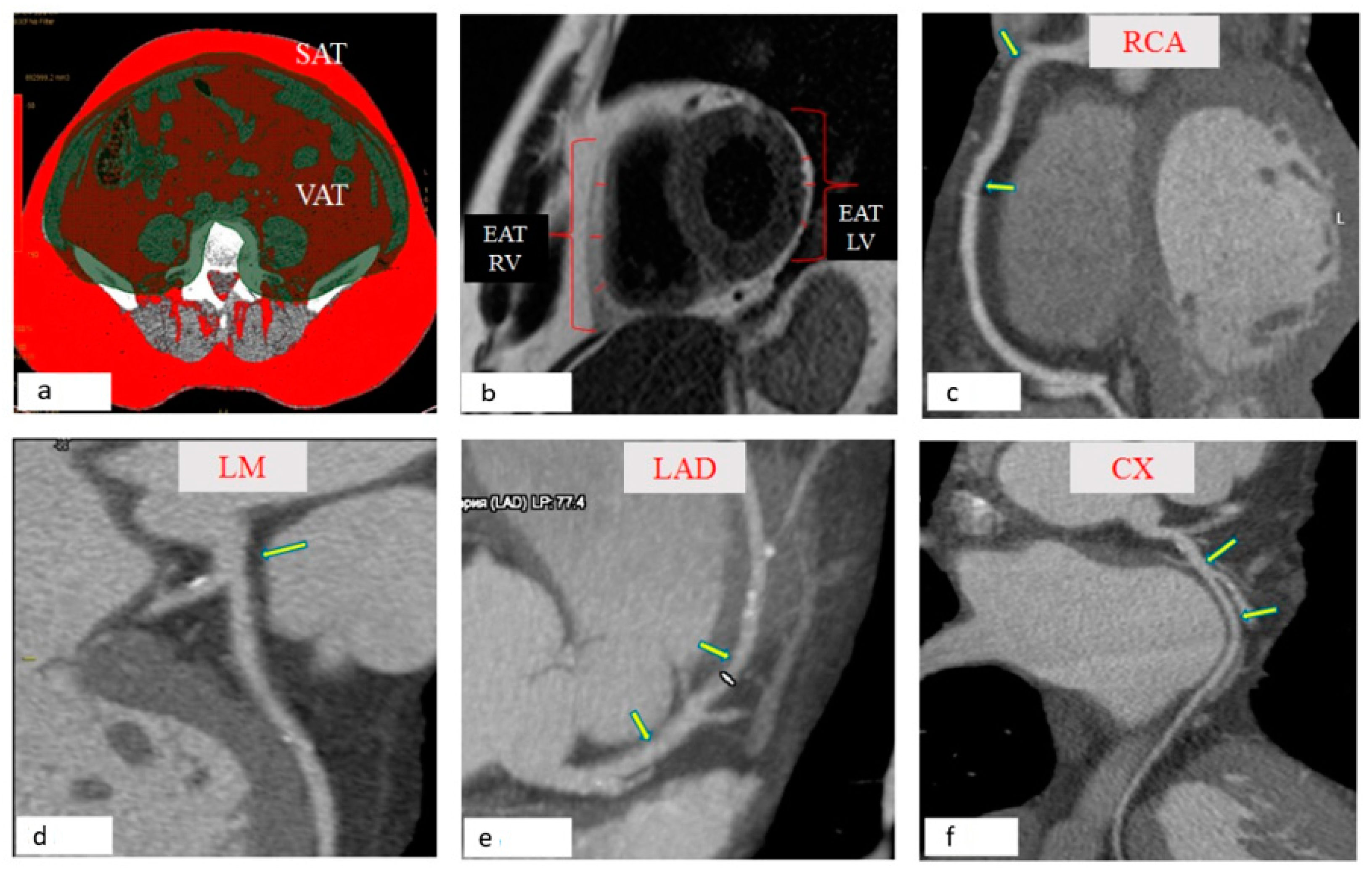 Jpm 12 00129 g001 Jpm 12 00129 g001