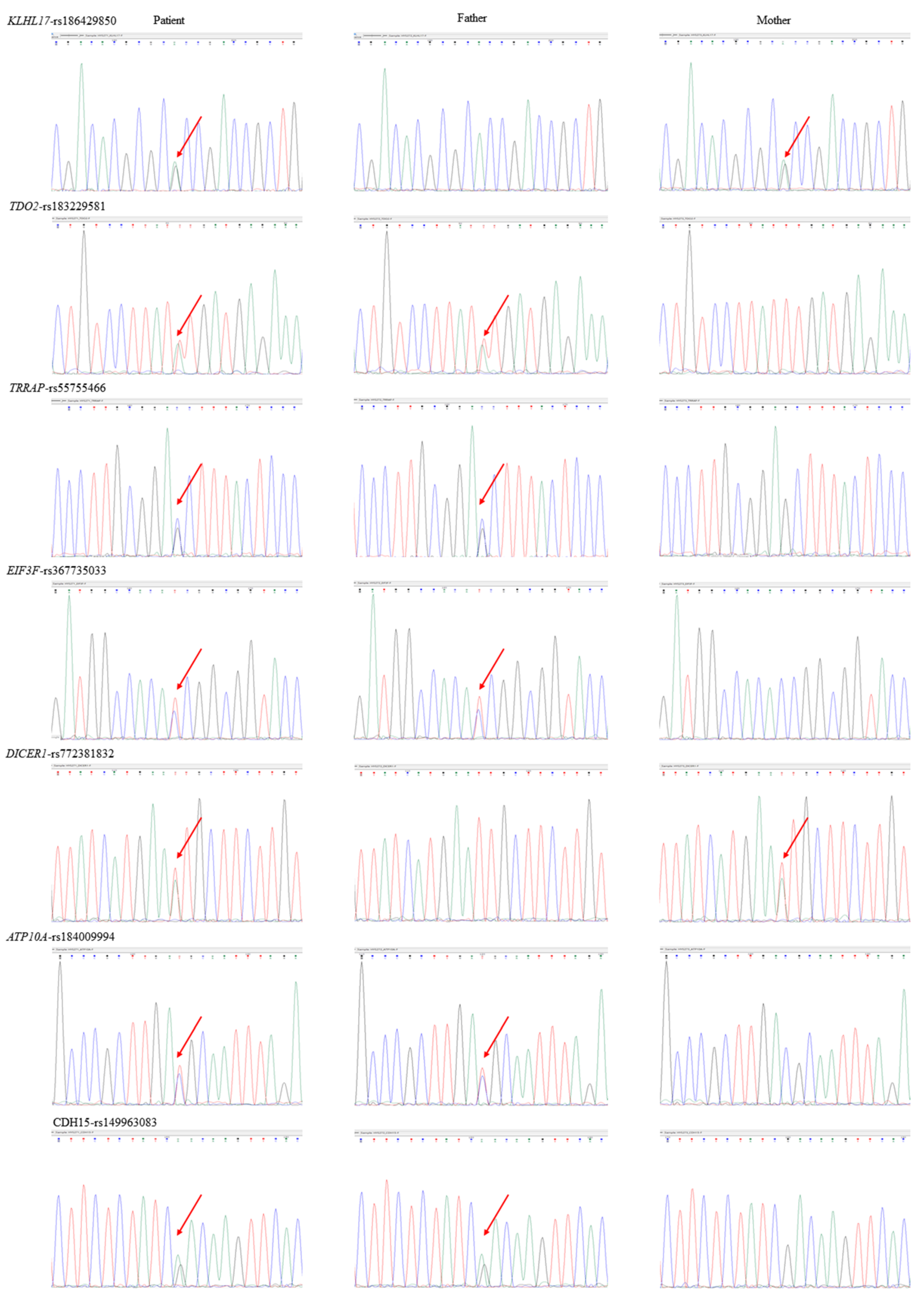Jpm 12 01013 g004 Jpm 12 01013 g004