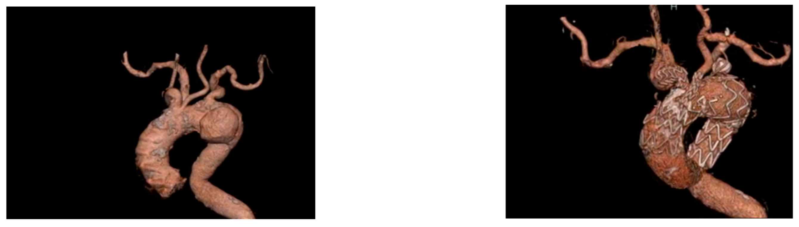 Jpm 12 01279 g003 Jpm 12 01279 g003