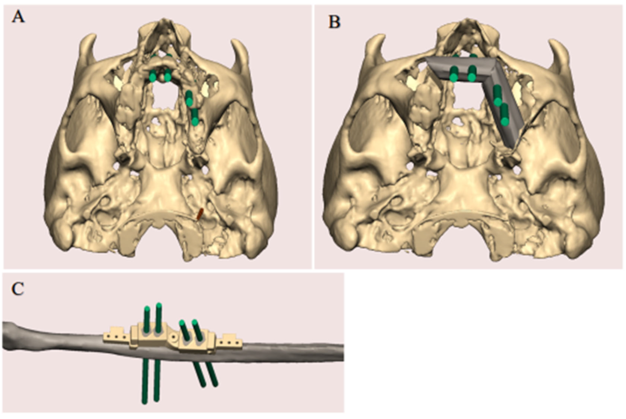 Jpm 12 01766 g001 Jpm 12 01766 g001