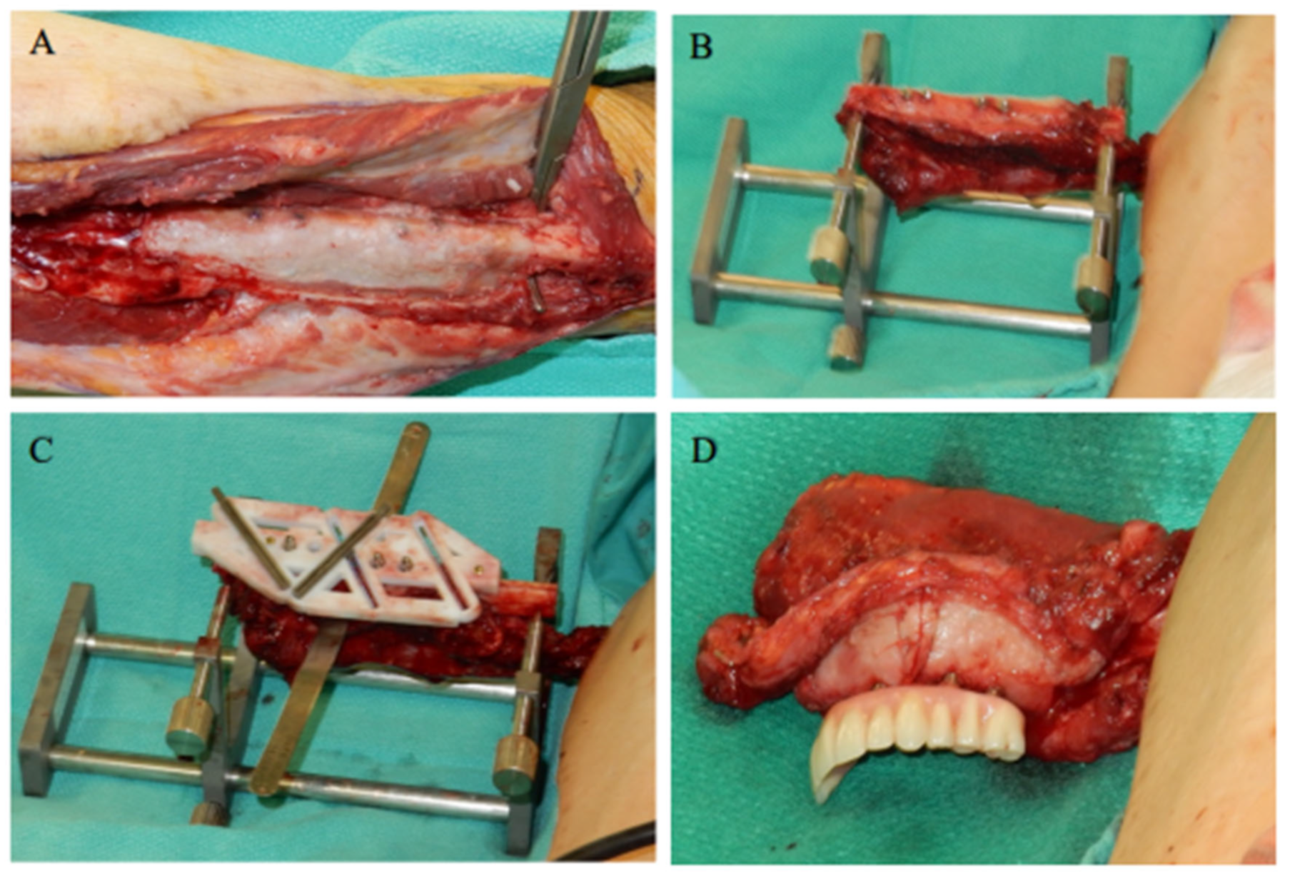 Jpm 12 01766 g003 Jpm 12 01766 g003