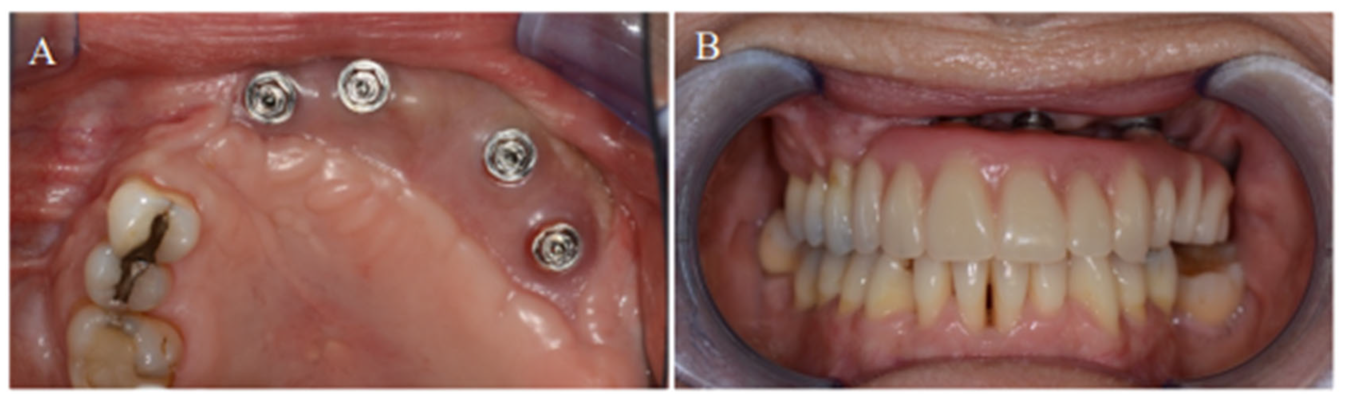 Jpm 12 01766 g004 Jpm 12 01766 g004