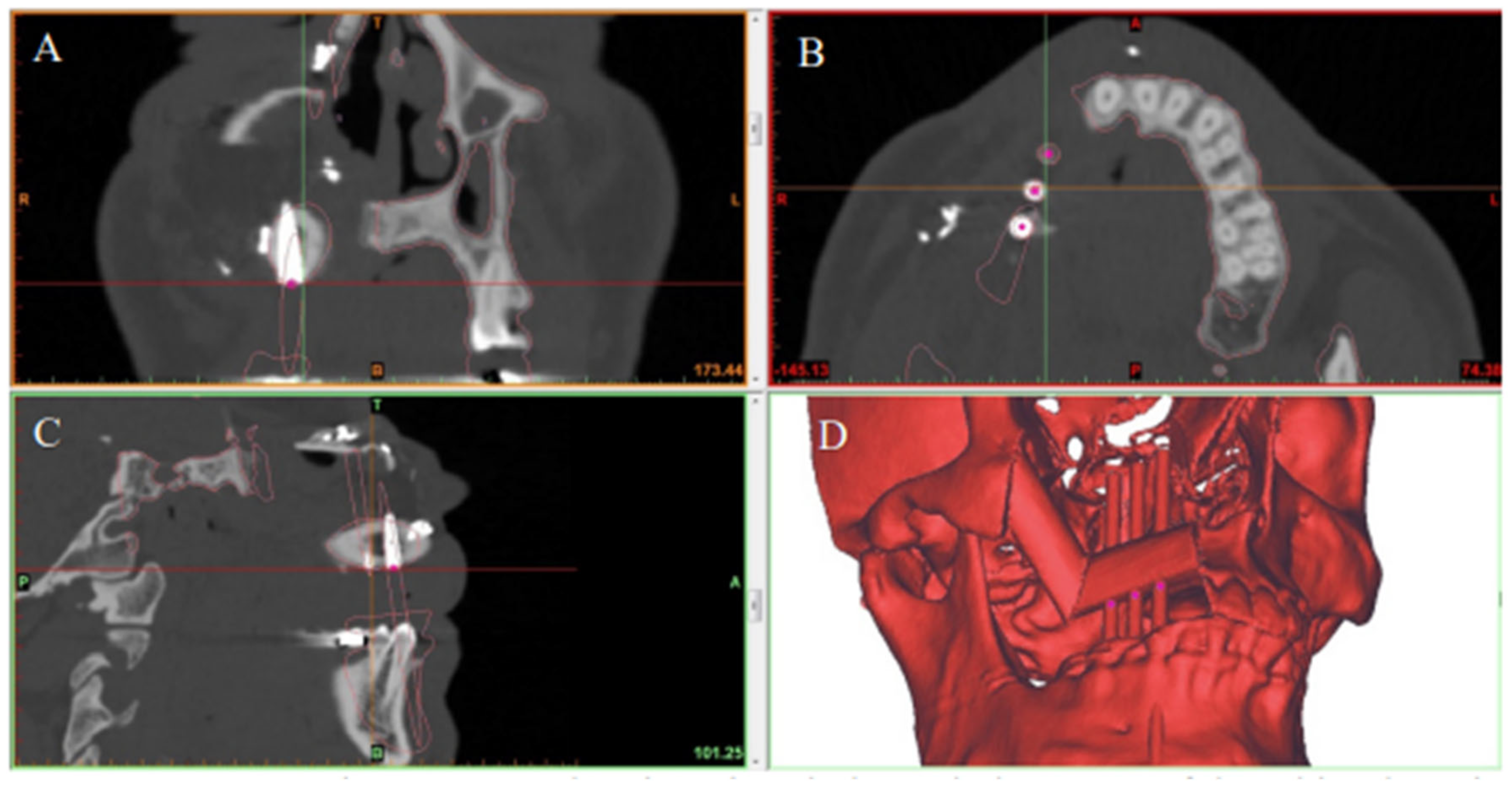 Jpm 12 01766 g005 Jpm 12 01766 g005