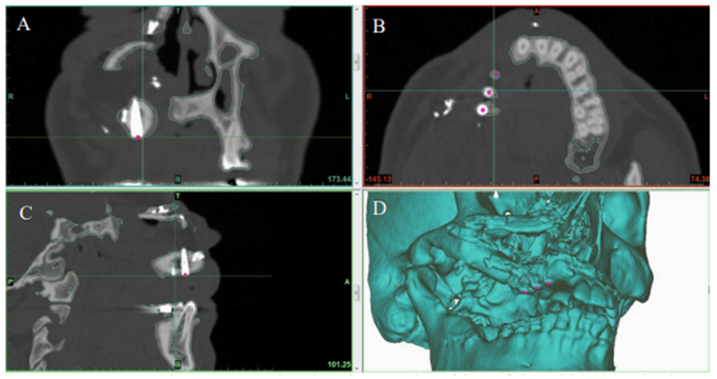 Jpm 12 01766 g006 Jpm 12 01766 g006