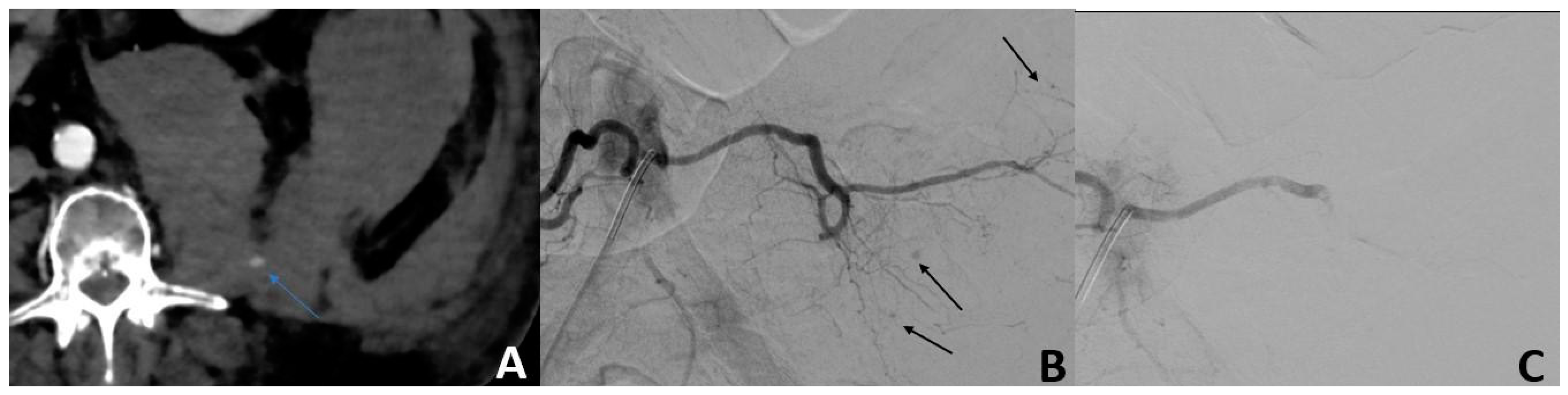 Jpm 13 00015 g001 Jpm 13 00015 g001