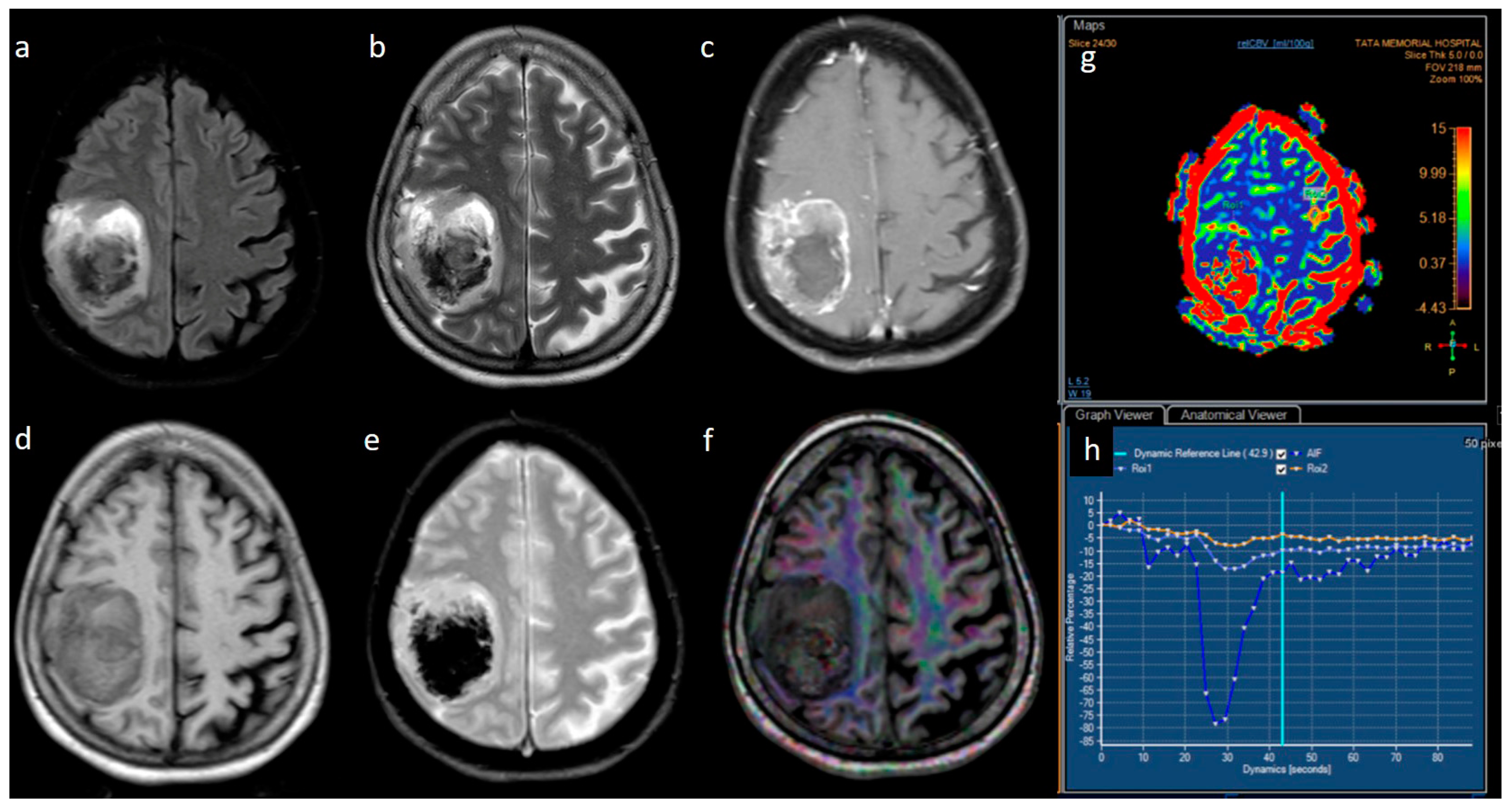 Jpm 13 00072 g002 Jpm 13 00072 g002