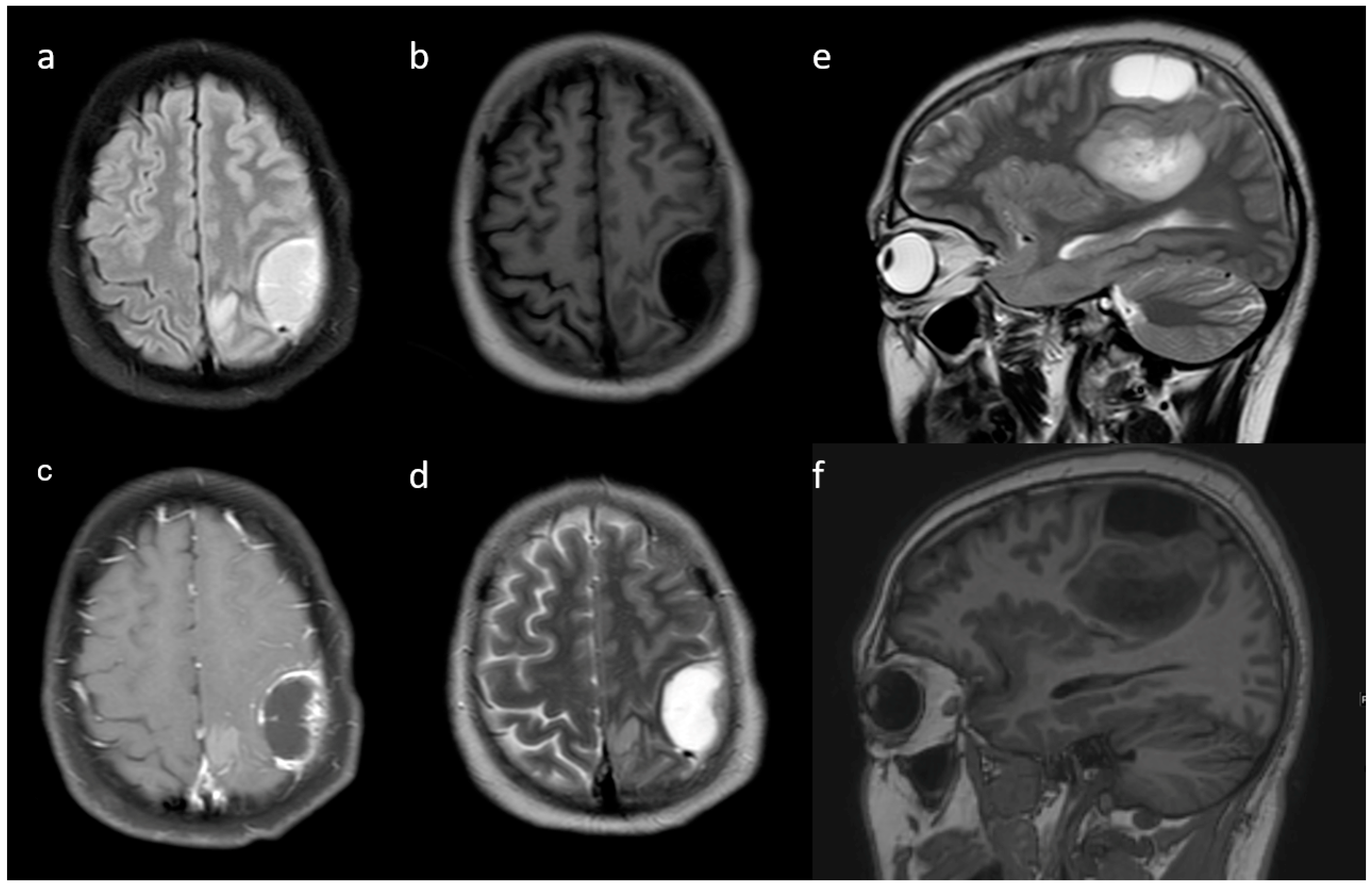 Jpm 13 00072 g004 Jpm 13 00072 g004