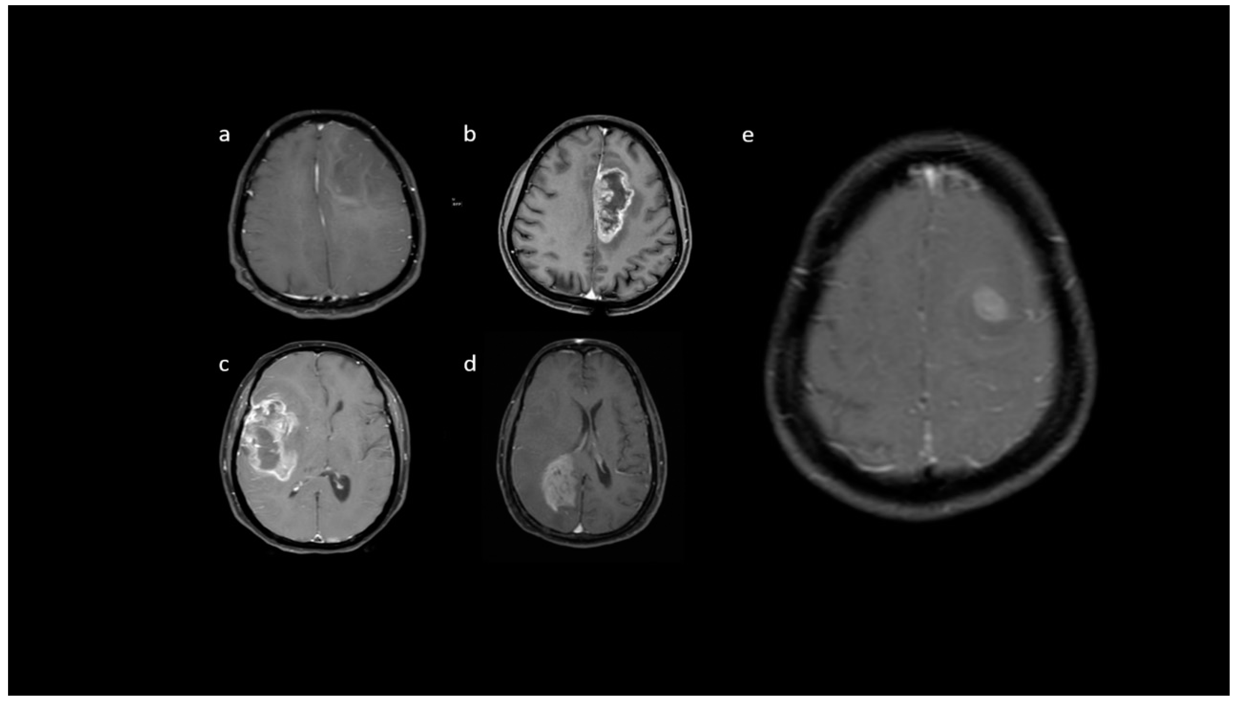 Jpm 13 00072 g008 Jpm 13 00072 g008