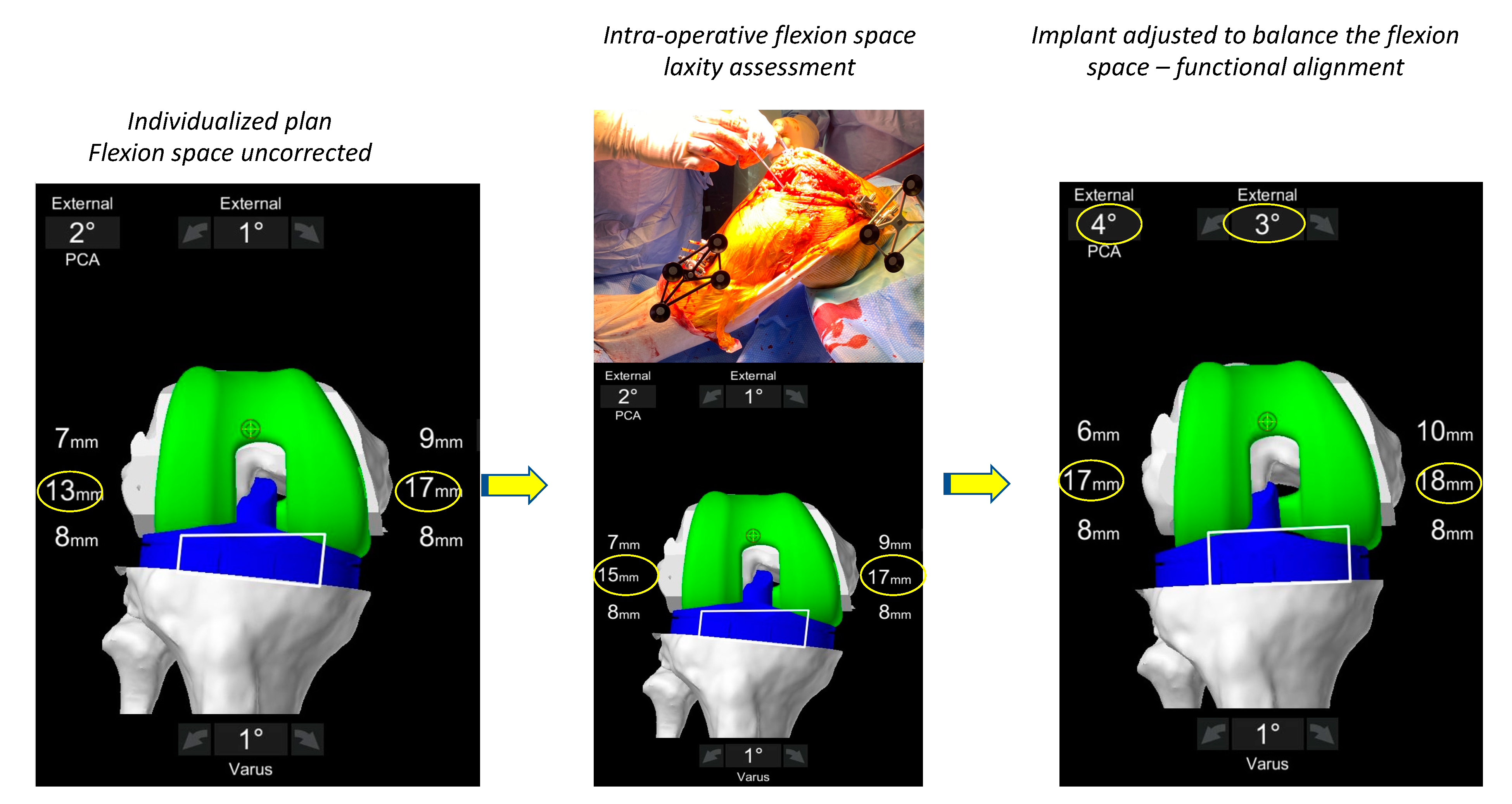 Jpm 13 00212 g004 Jpm 13 00212 g004