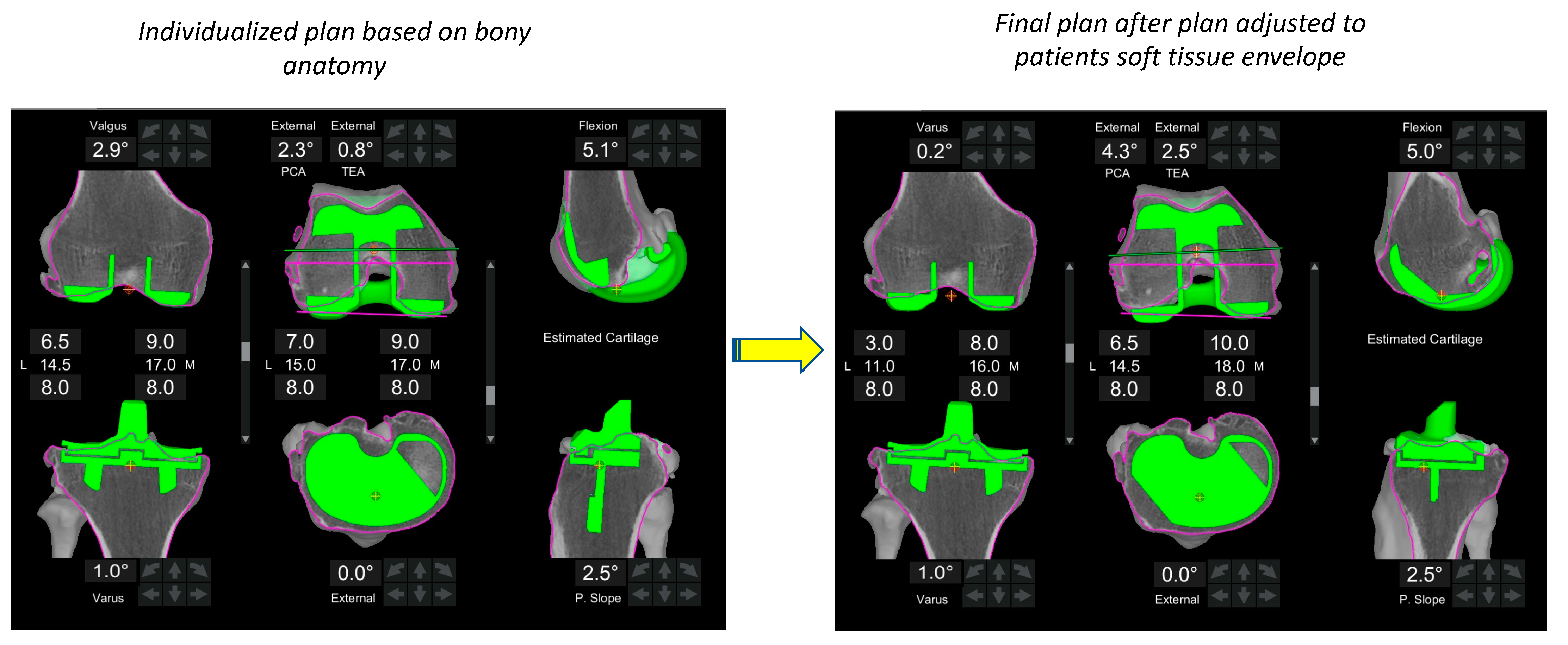 Jpm 13 00212 g006 Jpm 13 00212 g006