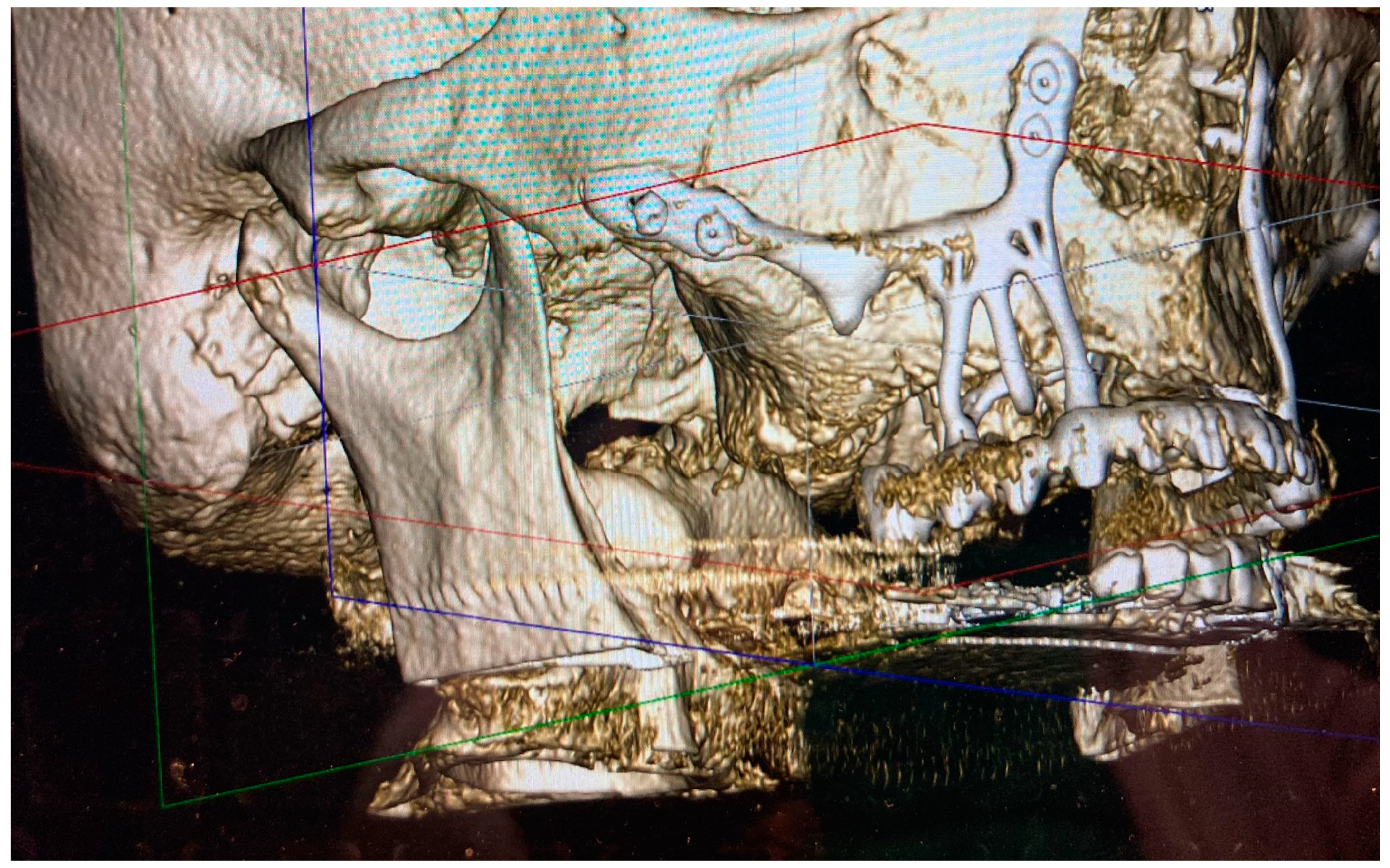 Jpm 13 00297 g002 Jpm 13 00297 g002