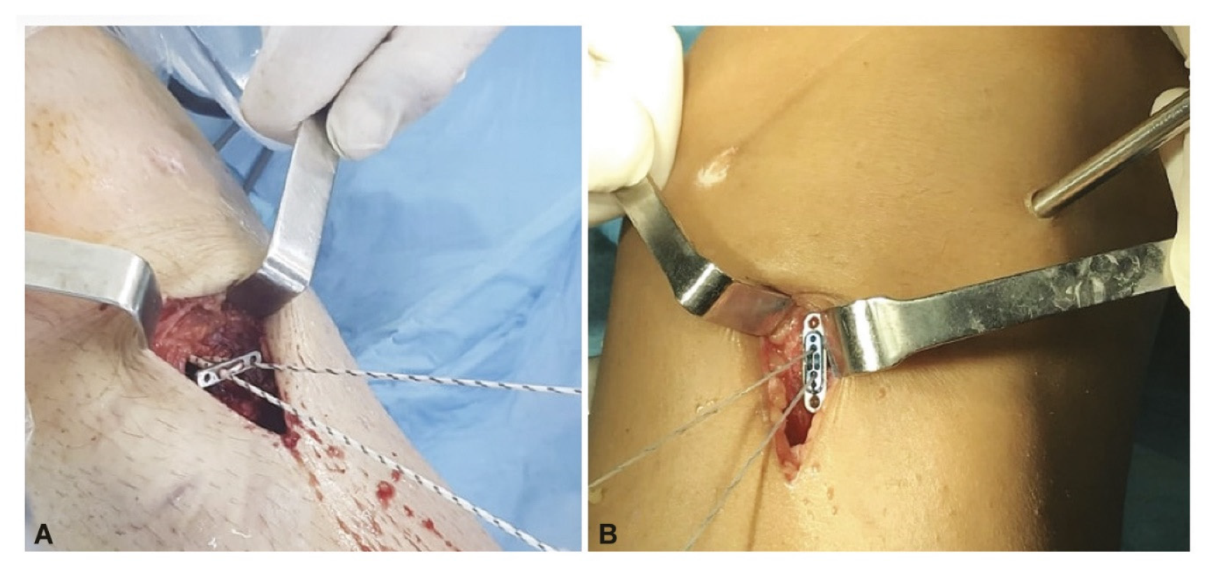 Jpm 13 00466 g002 Jpm 13 00466 g002