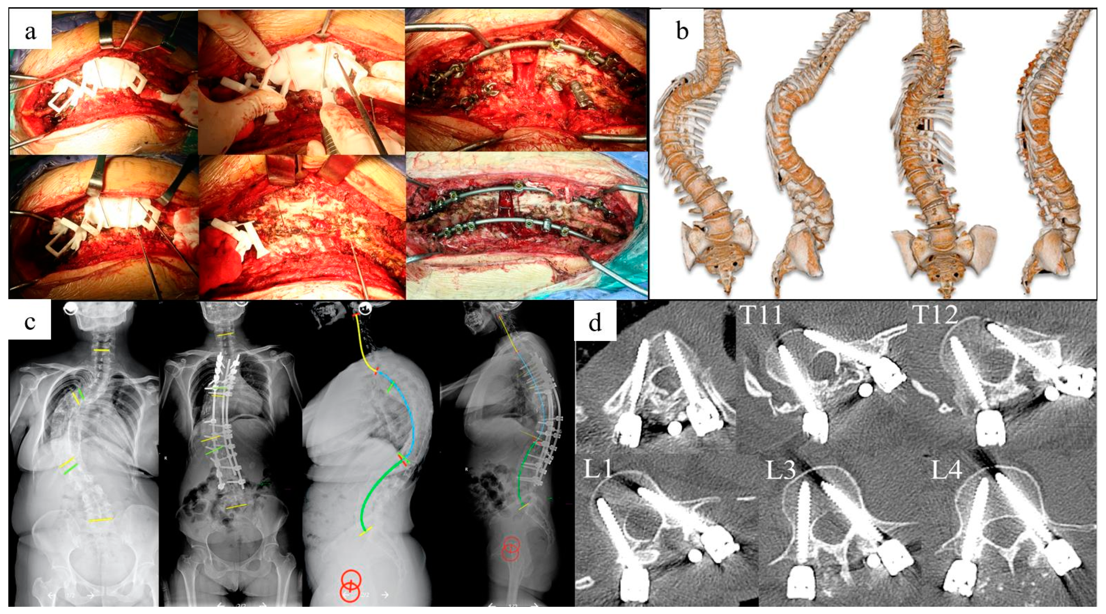 Jpm 13 00602 g008 Jpm 13 00602 g008