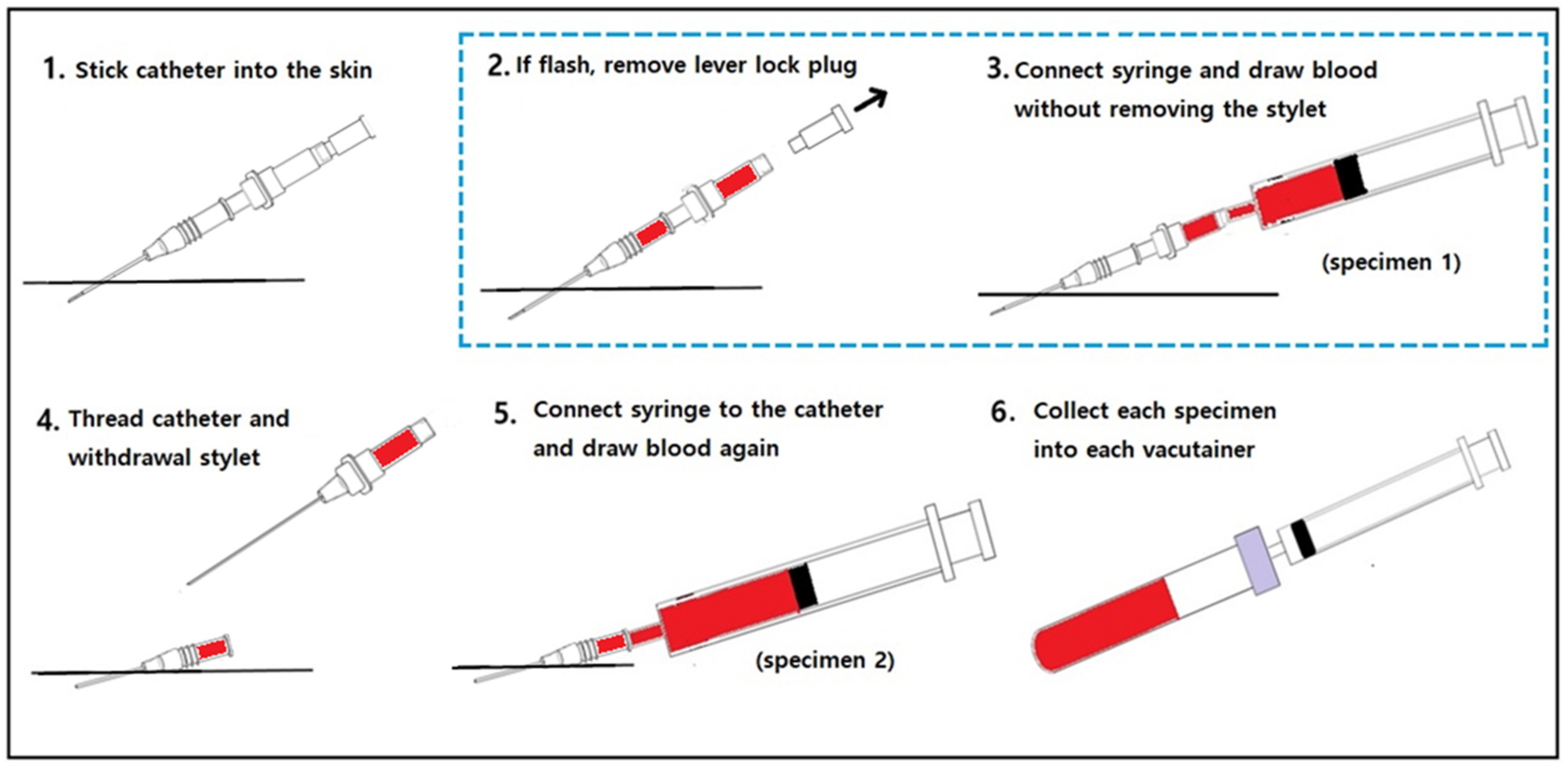 JPM Free FullText Hemolysis Control in the Emergency Department by