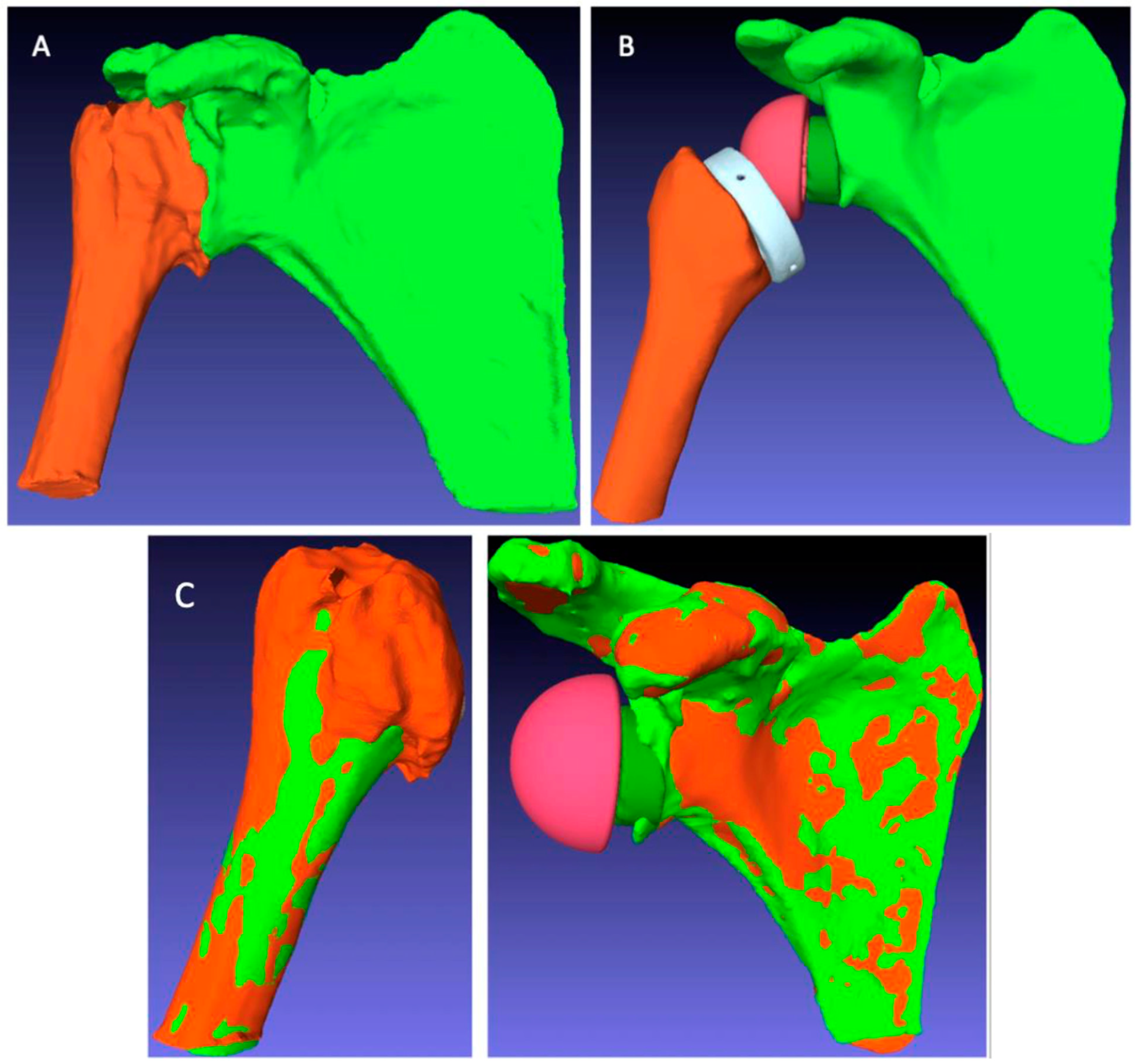 Jpm 13 00771 g005 Jpm 13 00771 g005