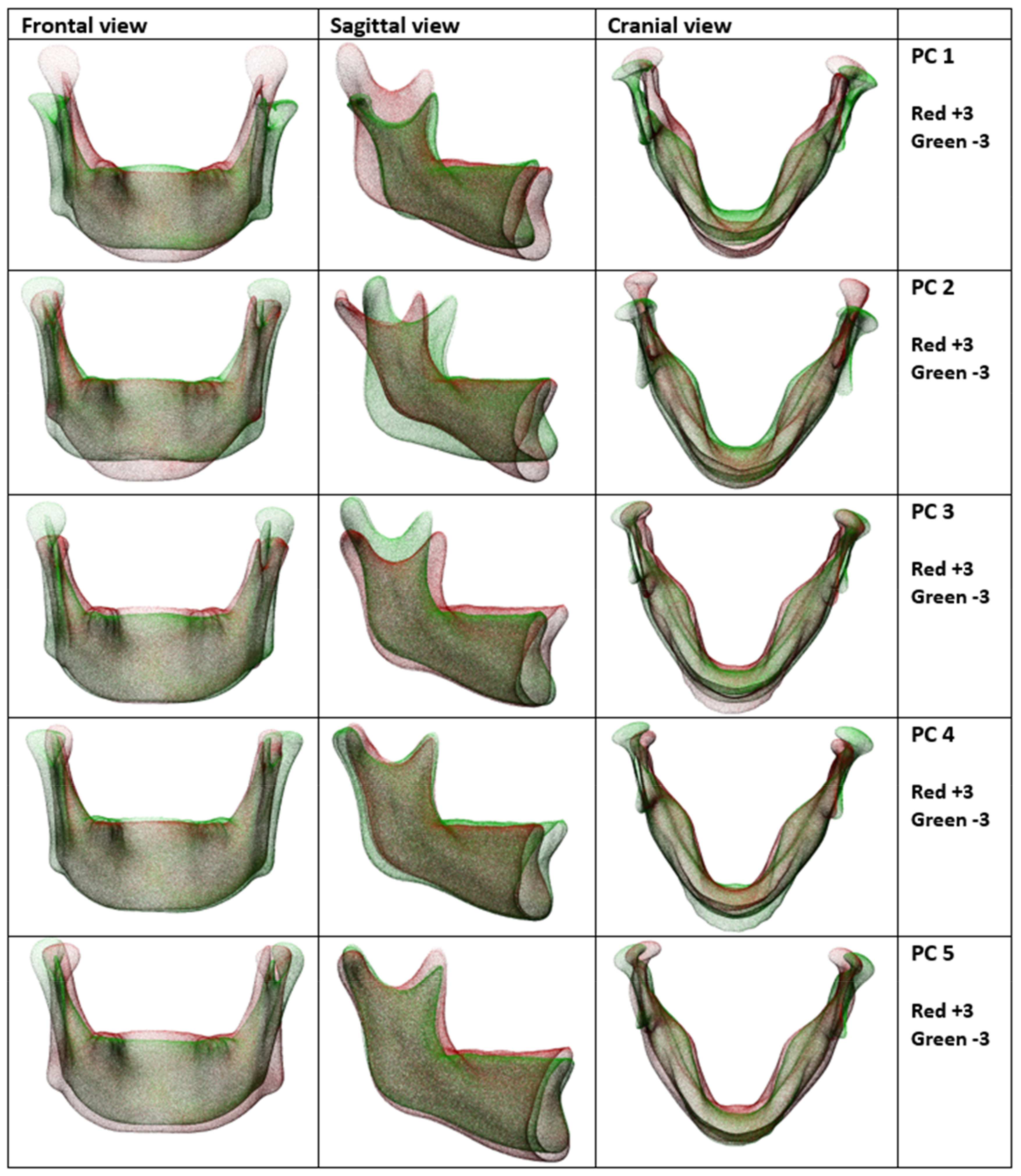 Jpm 13 00854 g004 Jpm 13 00854 g004