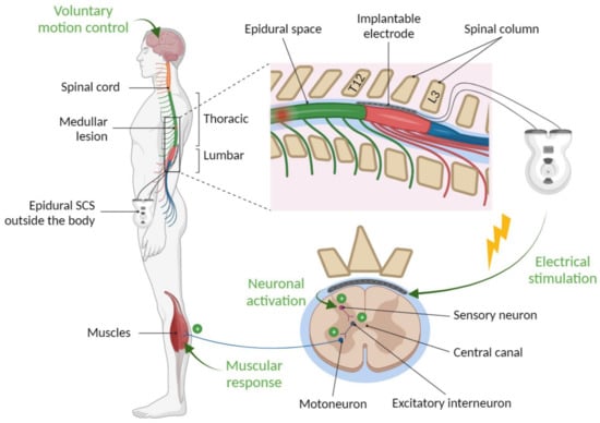 Spinal Cord Stimulation: What Clinicians Need to Know