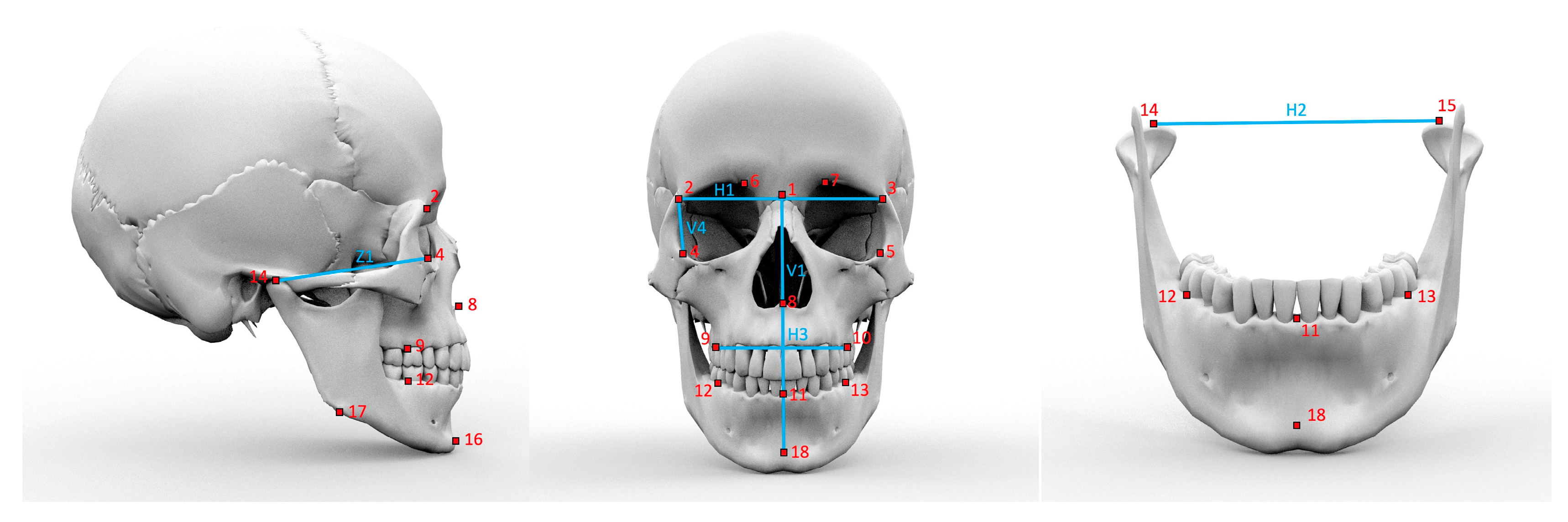 Comparison of skull morphology. The 3D reconstructions of the skulls