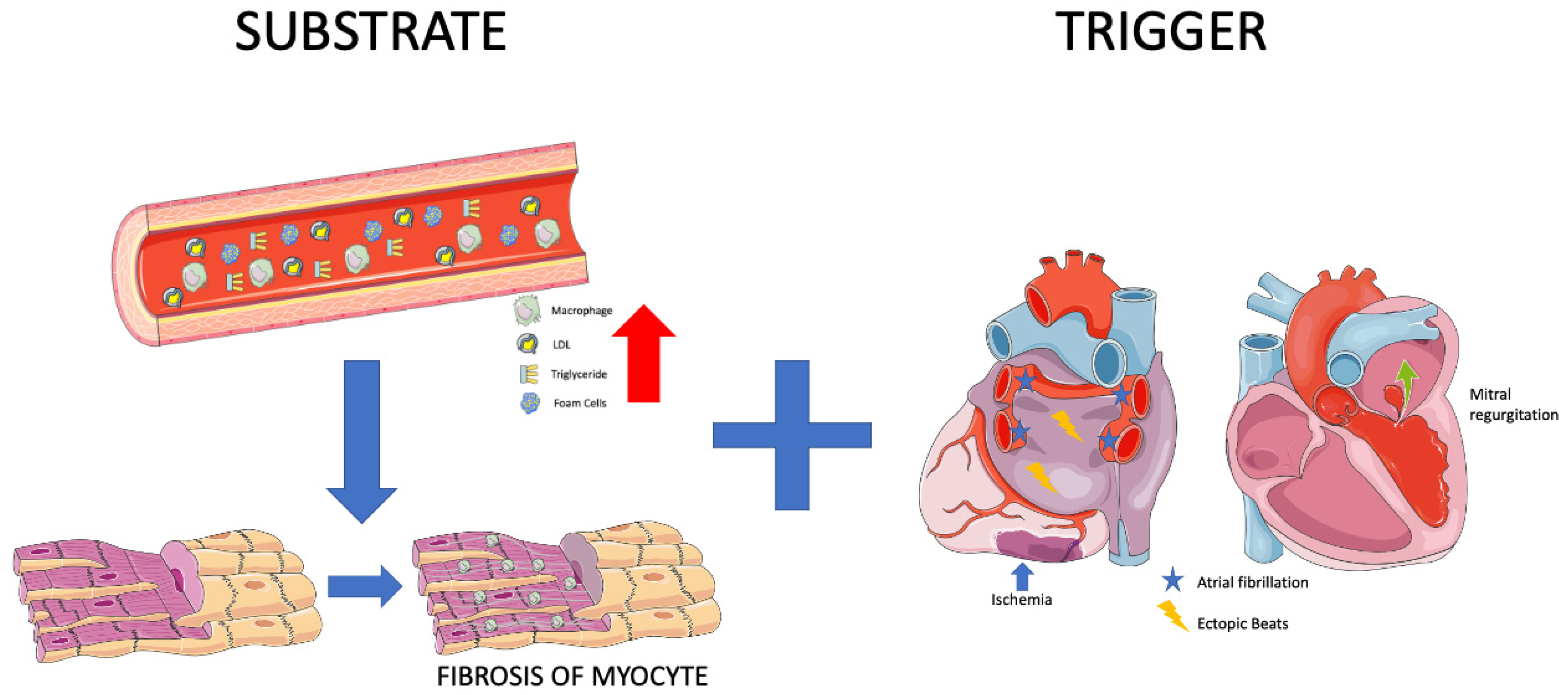 JPM | Free Full-Text | Metabolic Syndrome and Atrial Fibrillation