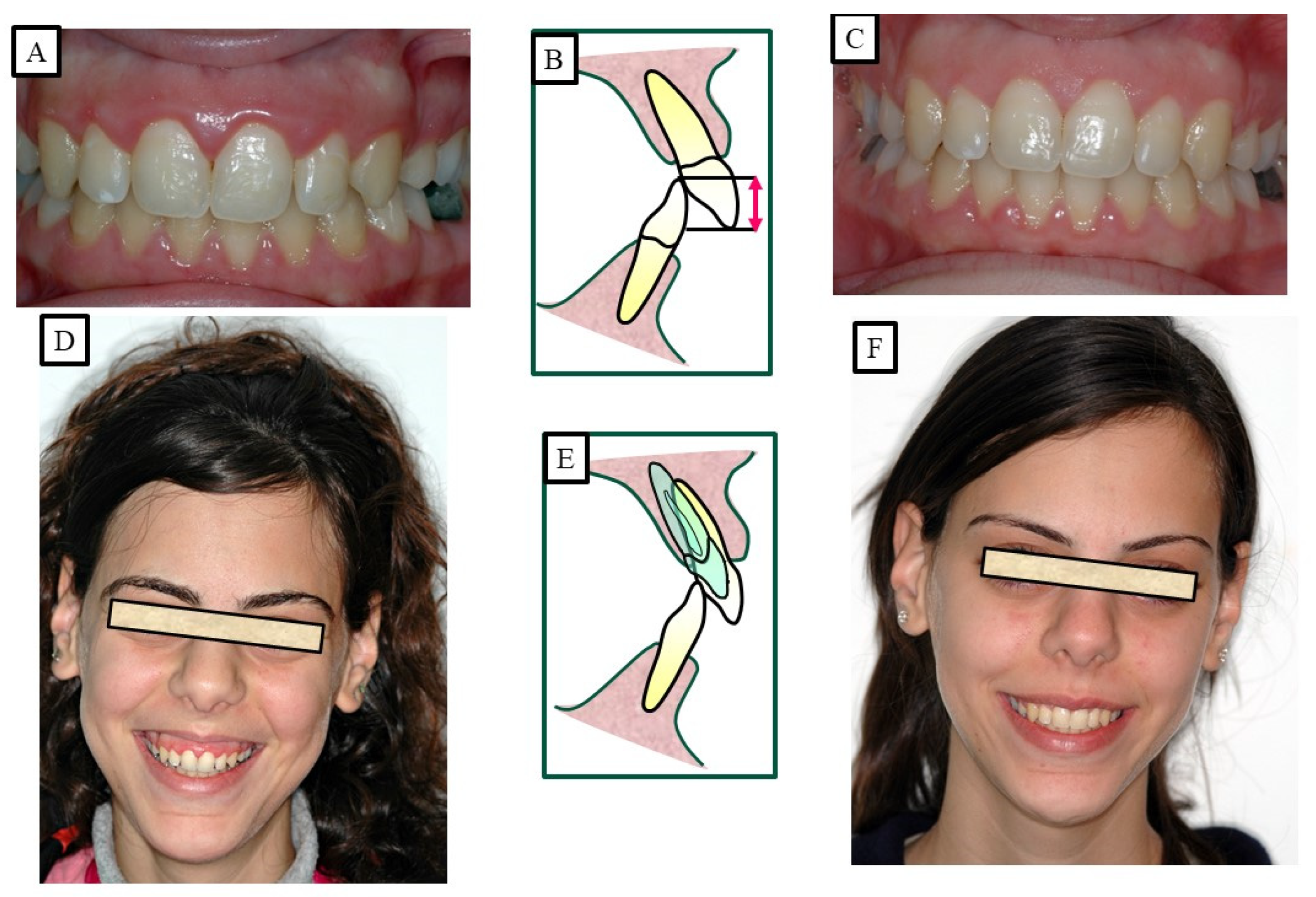 Jpm 13 01472 g008 Jpm 13 01472 g008